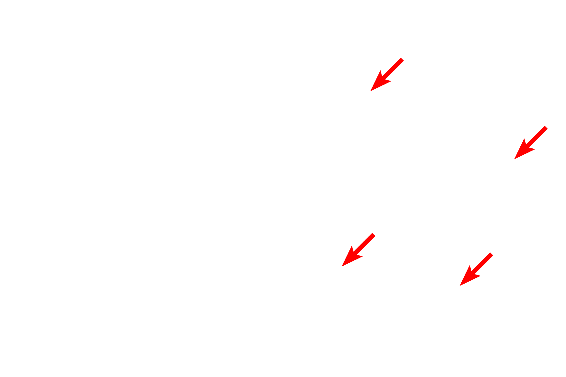 Osteocyte lacunae > <p>Osteocytes are not retained in the ground bone preparation. The lacunae in which they are located appear as elongated black spaces. </p>