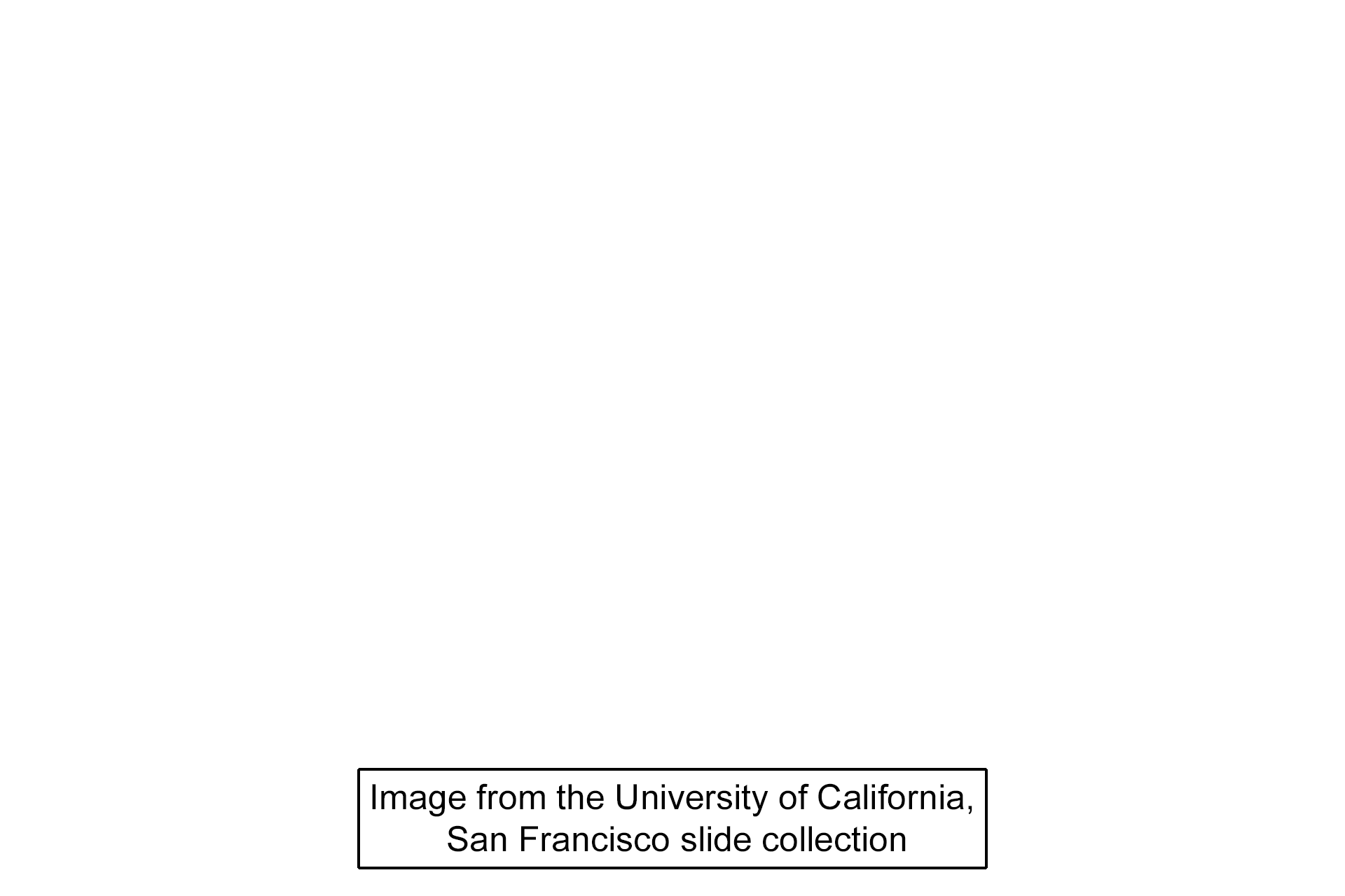 Image source > <p>Images taken of a slide in the University of California, San Francisco slide collection. </p>