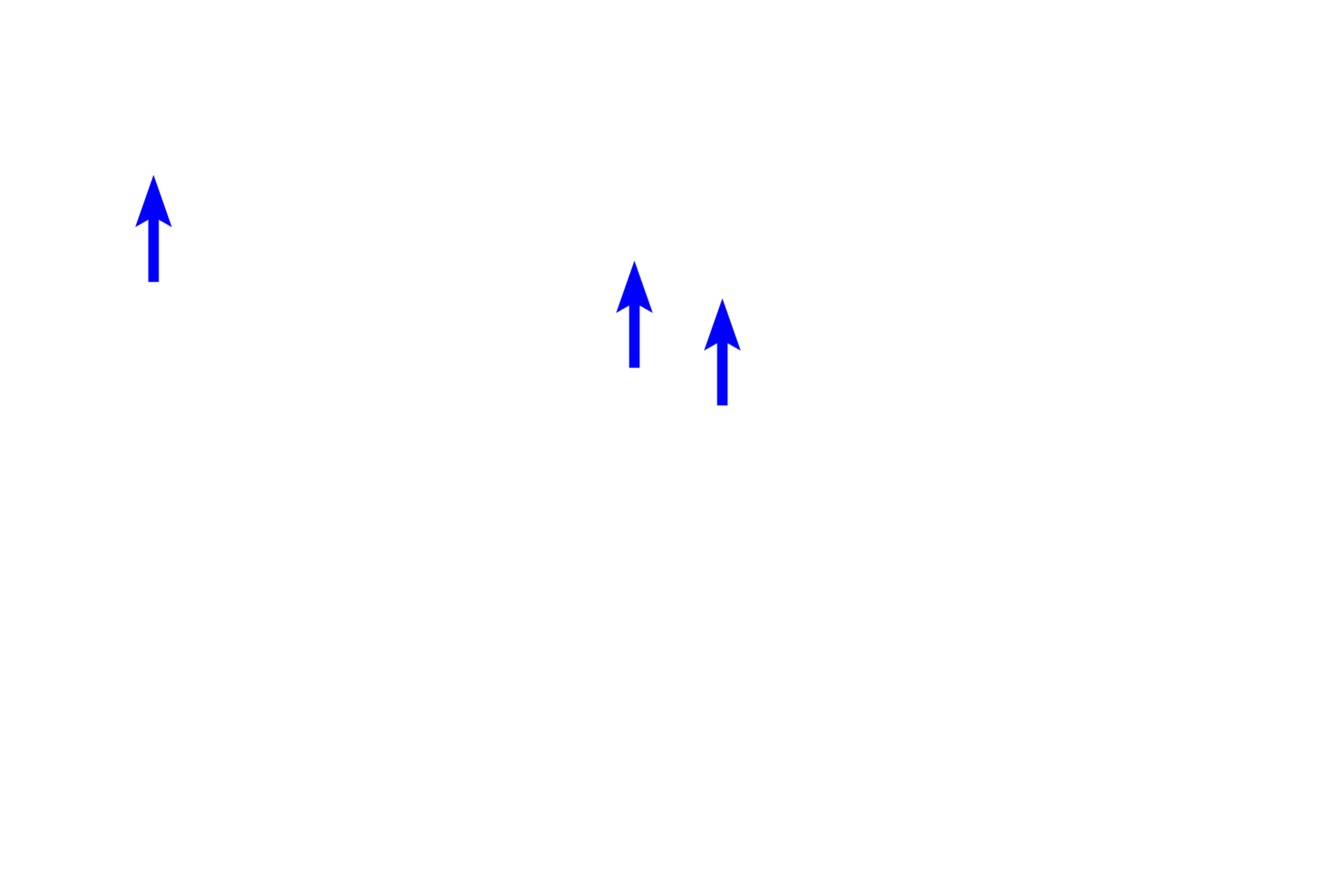 Ejaculatory ducts > <p>Ejaculatory ducts are paired structures, each formed by the union of the ductus deferens with the duct of the seminal vesicle. Ejaculatory ducts traverse the prostate gland and empty into the prostatic urethra at the seminal colliculus.</p>