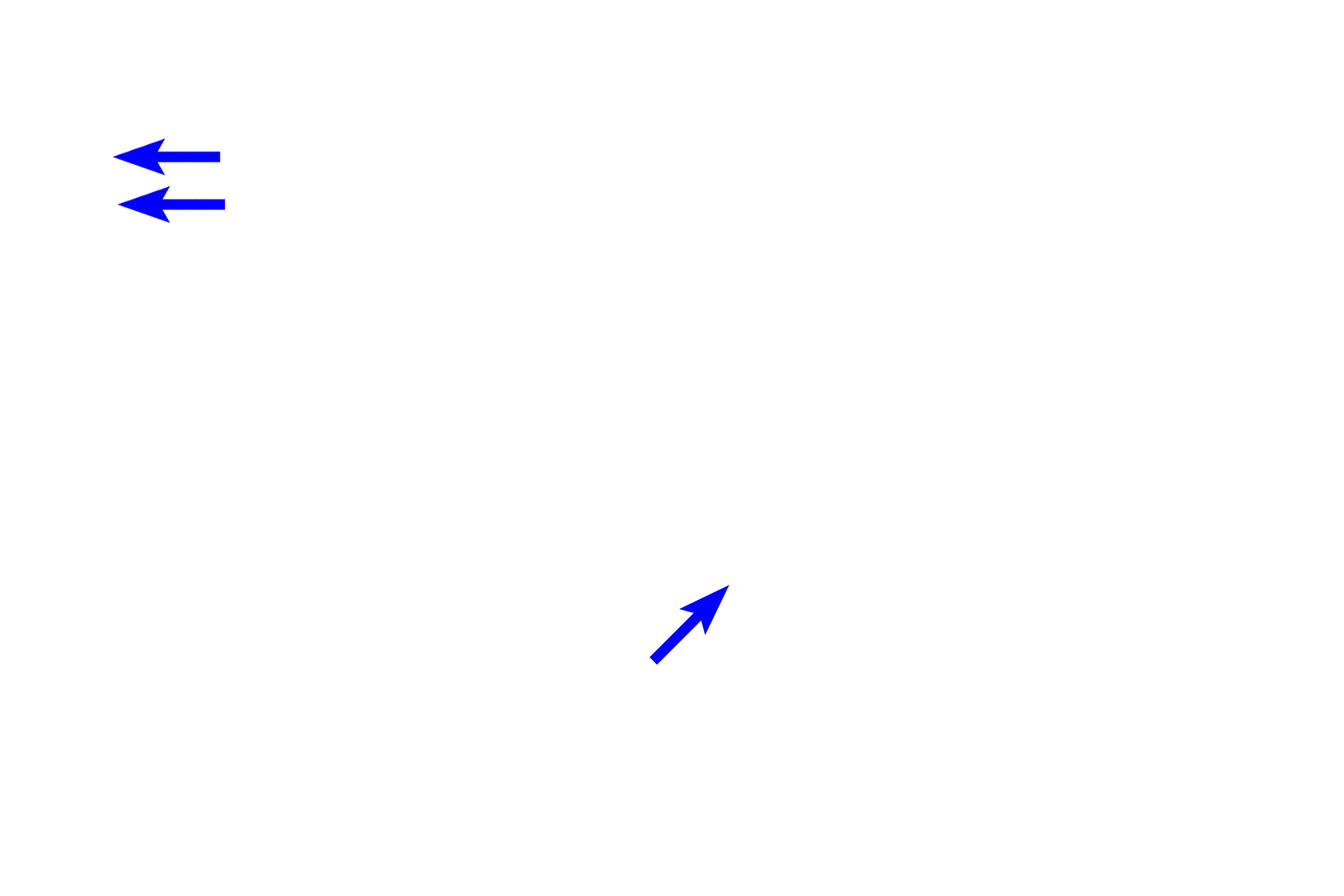 Prostatic urethra > <p>The prostatic urethra receives the secretions of the prostate gland. It passes out of the prostate as the membranous urethra and becomes the penile (spongy) urethra that runs the length of the penis. </p>