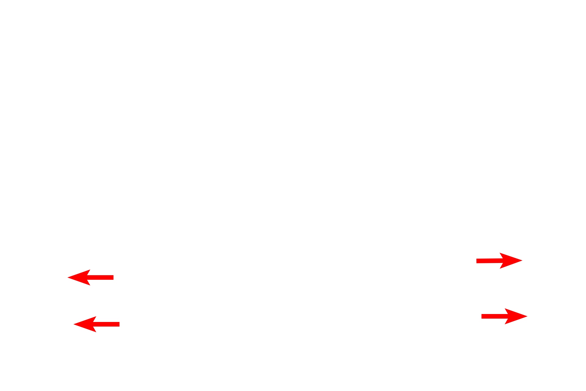 Epiphyseal lines > <p>Growth of bone in length ceases when the epiphyseal plate stops functioning and is replaced by bone (epiphyseal plate closure), leaving an epiphyseal line in its place.</p>