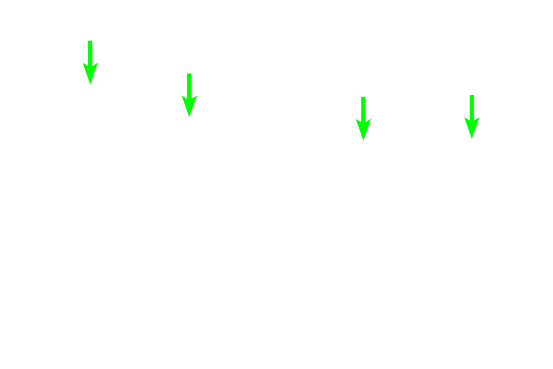 Epiphyseal plate > <p>Long bones grow in length from a plate of hyaline cartilage, called the epiphyseal plate, located between the epiphysis and the metaphysis. The plate is indicated in the decalcified section on the right; its located is indicated in the dried bone on the left. </p>