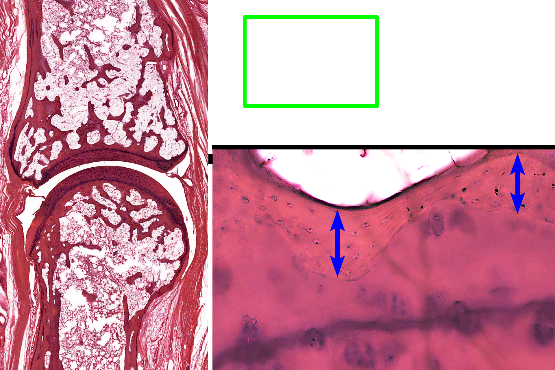 - Bone <p>This higher magnification of the area indicated by the green rectangle shows the interface of the compact bone of the epiphysis with articular cartilage. Osteocytes in lacuna are evident in the compact bone.</p>