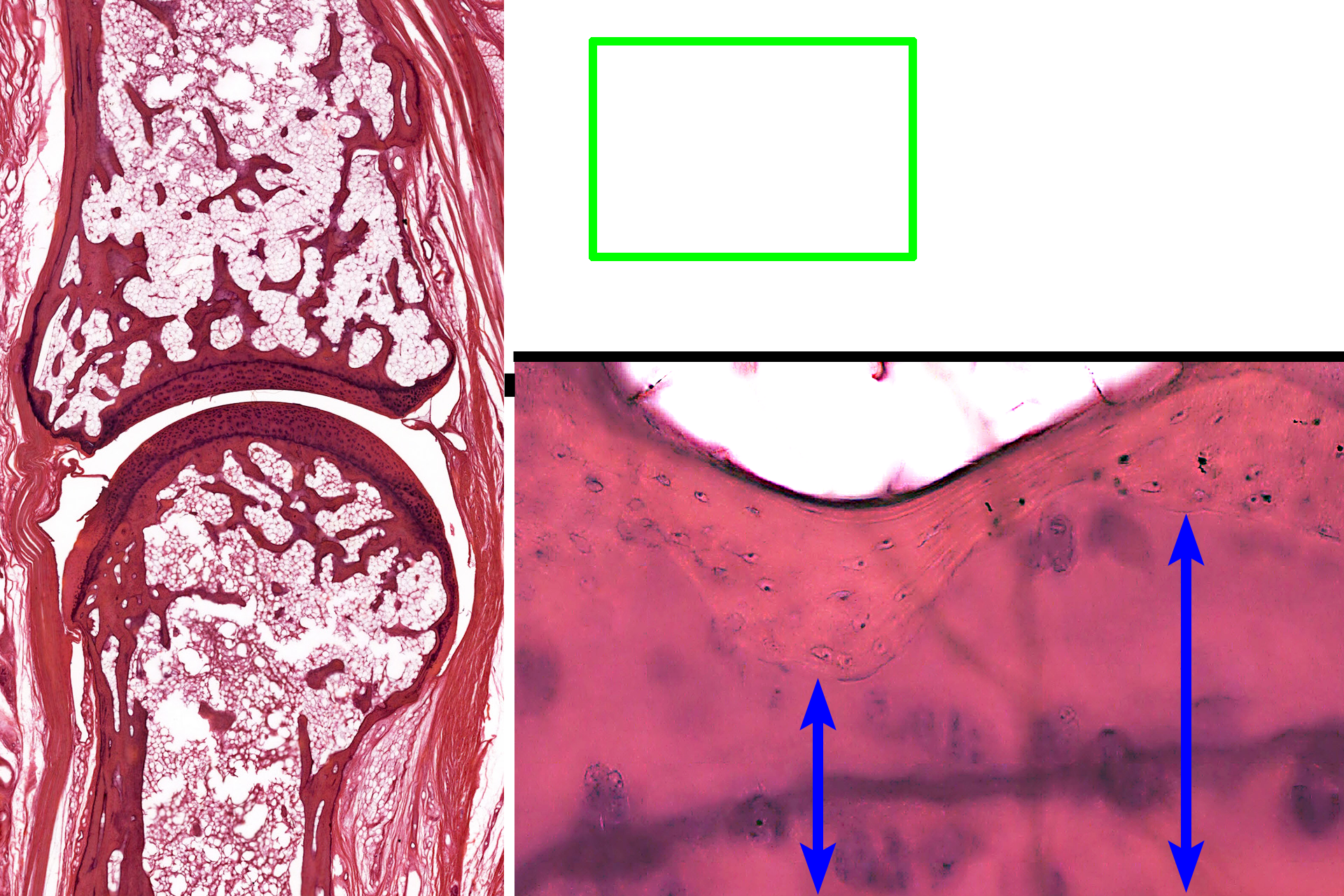 - Cartilage <p>This higher magnification of the area indicated by the green rectangle shows the interface of the compact bone of the epiphysis with articular cartilage. Osteocytes in lacuna are evident in the compact bone.</p>