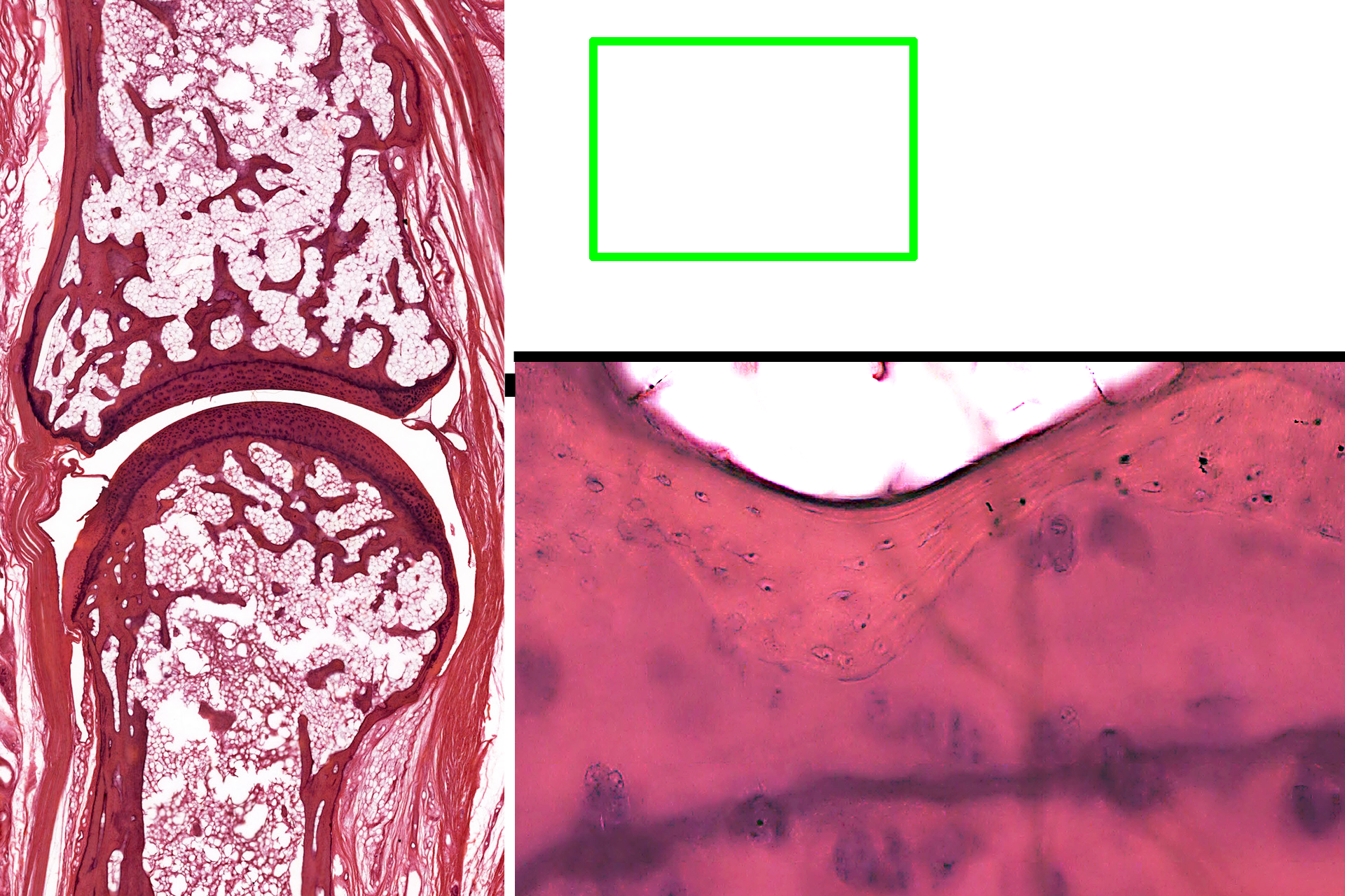 Bone-cartilage interface > <p>This higher magnification of the area indicated by the green rectangle shows the interface of the compact bone of the epiphysis with articular cartilage. Osteocytes in lacuna are evident in the compact bone.</p>