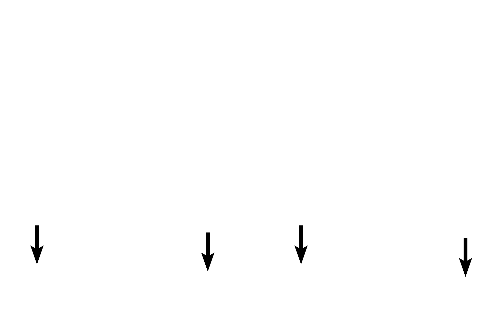 Muscularis mucosae <p>These images show lymphoid nodules in MALT. Nodules result from initial antigen detection in diffuse lymphoid tissues and the subsequent recruitment of additional immune cells to the region. 200x, 200x.</p>
