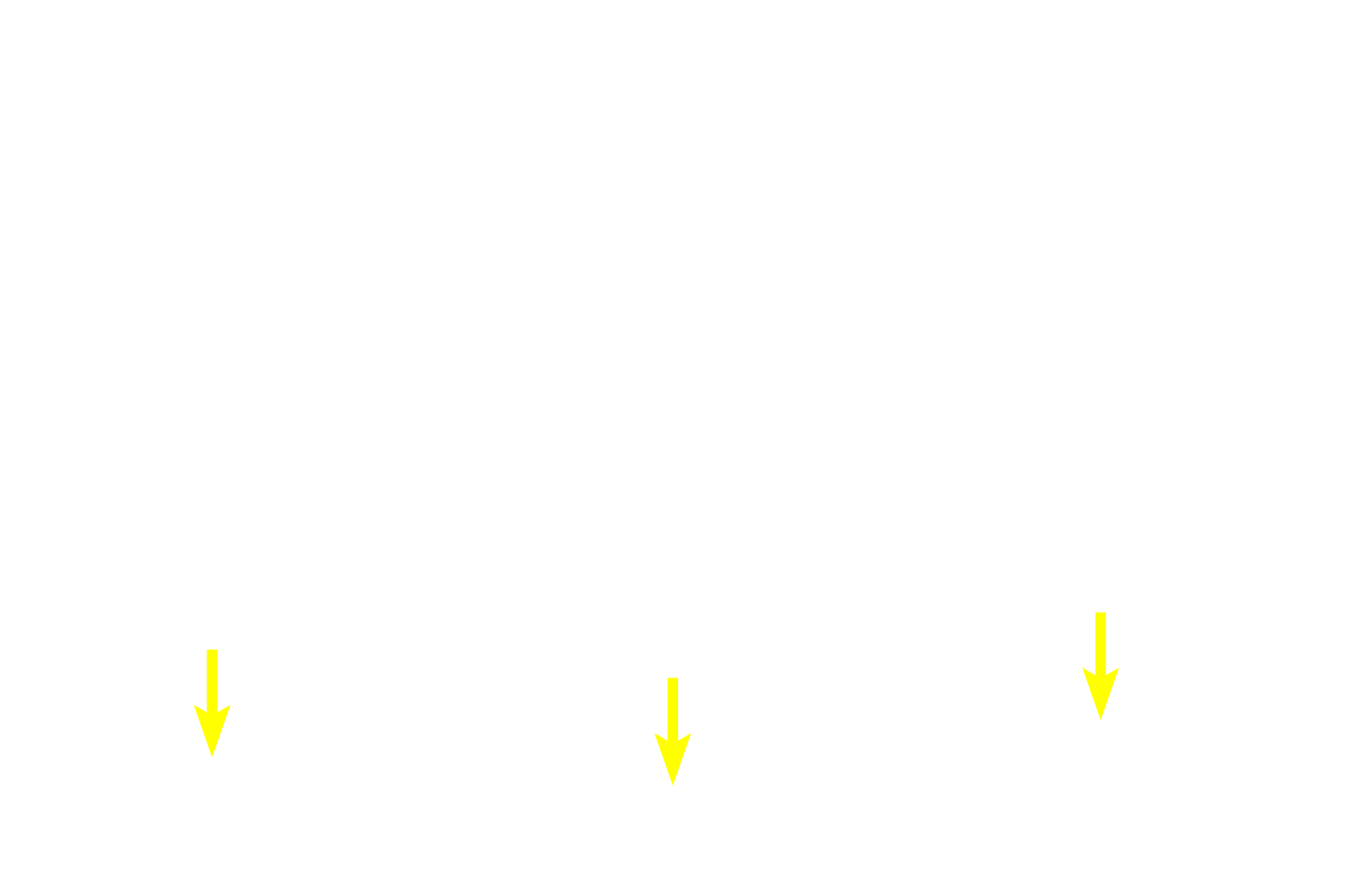 Muscularis mucosae <p>Diffuse lymphoid tissue is located in the lamina propria of the mucosa, where it filters tissue fluid percolating through the connective tissue. As such, it forms part of MALT (mucosa-associated lymphoid tissue). Pyloric stomach, 200x</p>
