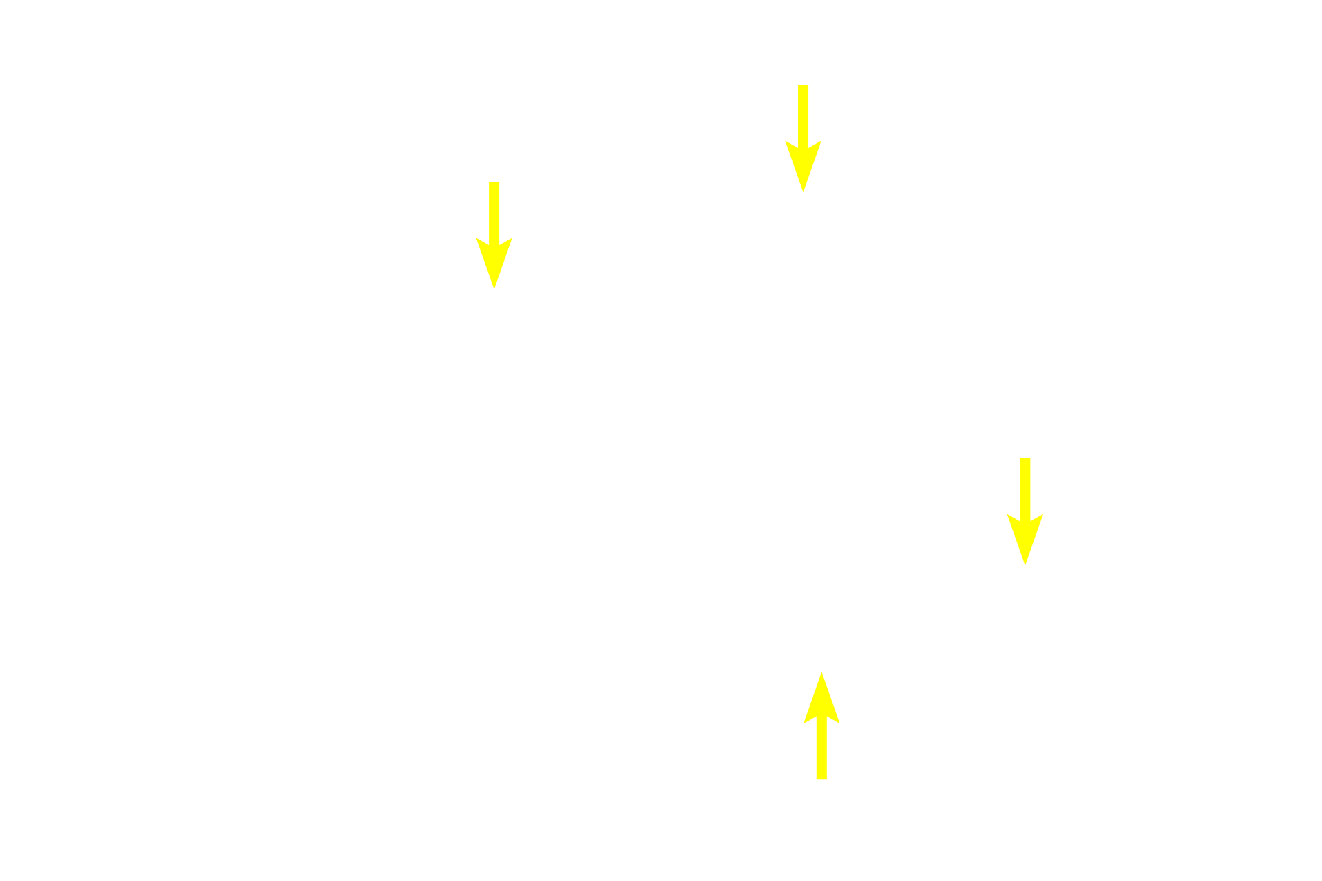  - Diffuse lymphoid tissue <p>The appendix is a narrow, blind-ended tube attached to the cecum, the initial region of the large intestine. Though considered a portion of the tubular digestive tract, the lamina propria of the appendix is heavily infiltrated with lymphoid tissue forming numerous secondary nodules. As such, the appendix is an important component of the mucosal immune system. 40x</p>
