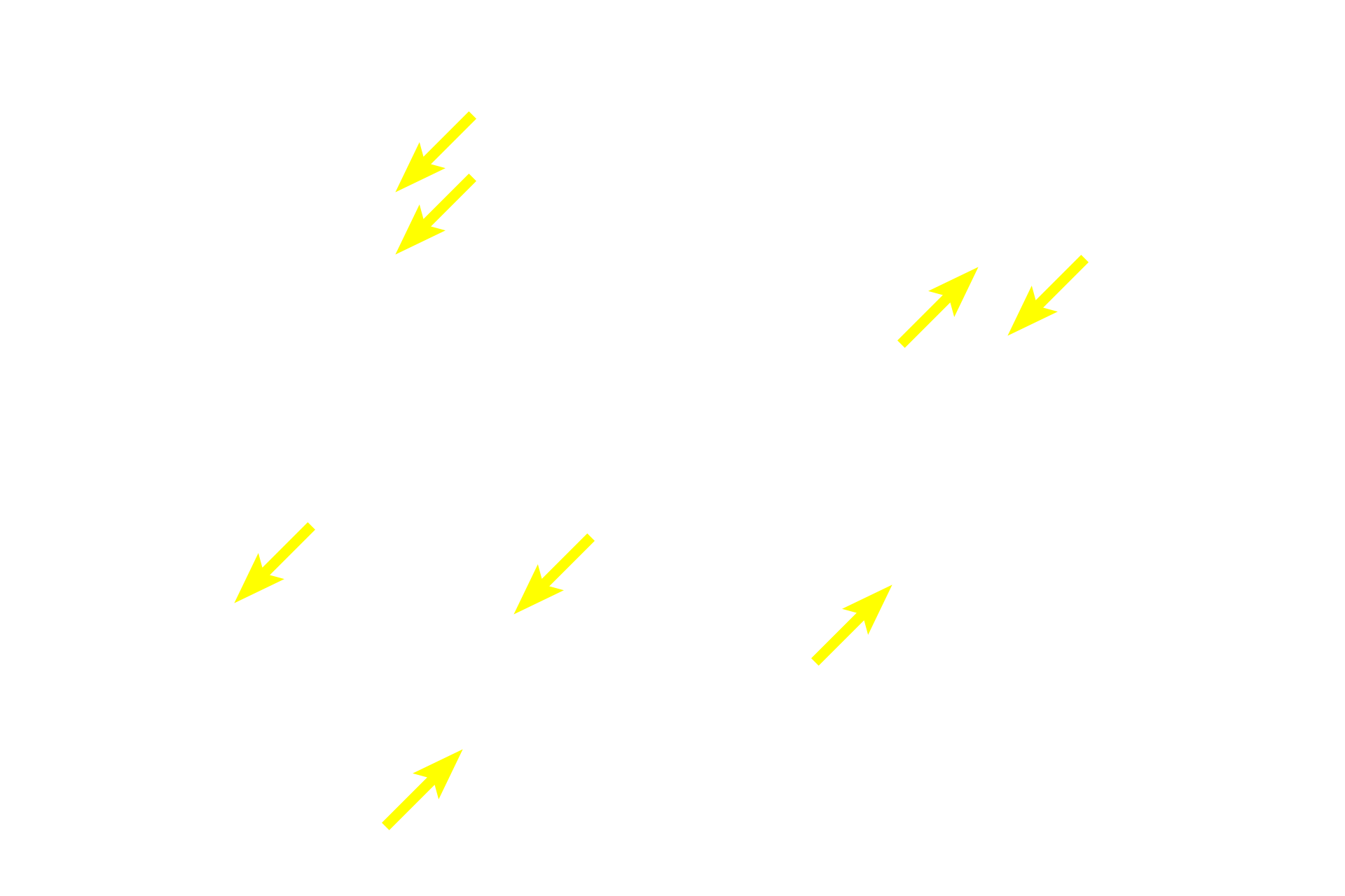 Endothelial cells <p>The structure of high endothelial venules (HEVs) is shown to advantage in these thin plastic sections. The unique cuboidal-shaped endothelial cells facilitate the migration (diapedesis) of lymphocytes from the blood into the surrounding tissues. These venules are surrounded by diffuse lymphoid tissue. HEVs are present in all secondary lymphoid tissues and organs except the spleen. The two images on the left show cross sections; the image on the right is a longitudinal section. Lymph node, 600x (left panels); 400x (right panel) </p>
