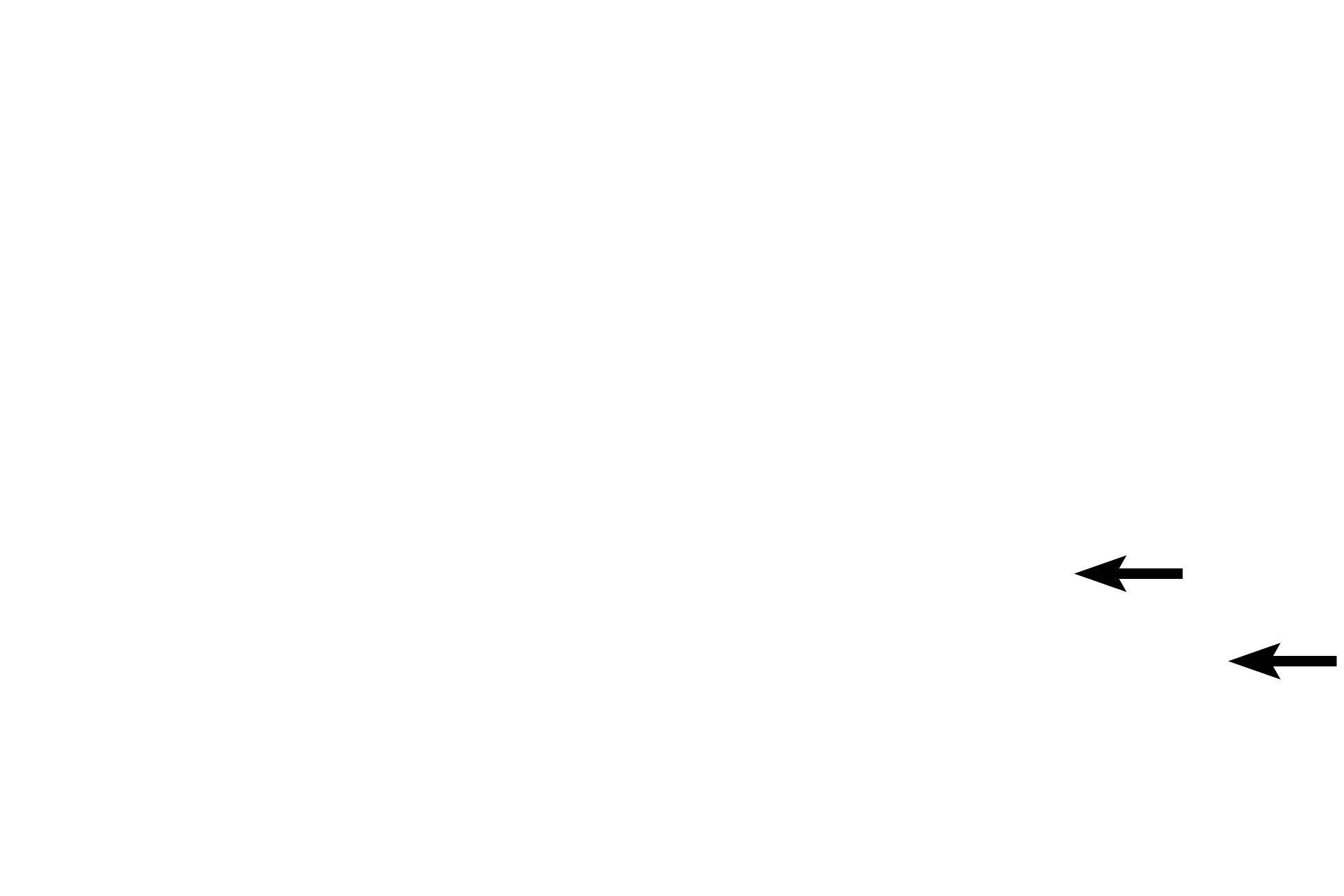  - Connective tissue <p>In larger vessels, valve leaflets are supported by a core of connective tissue.</p>
