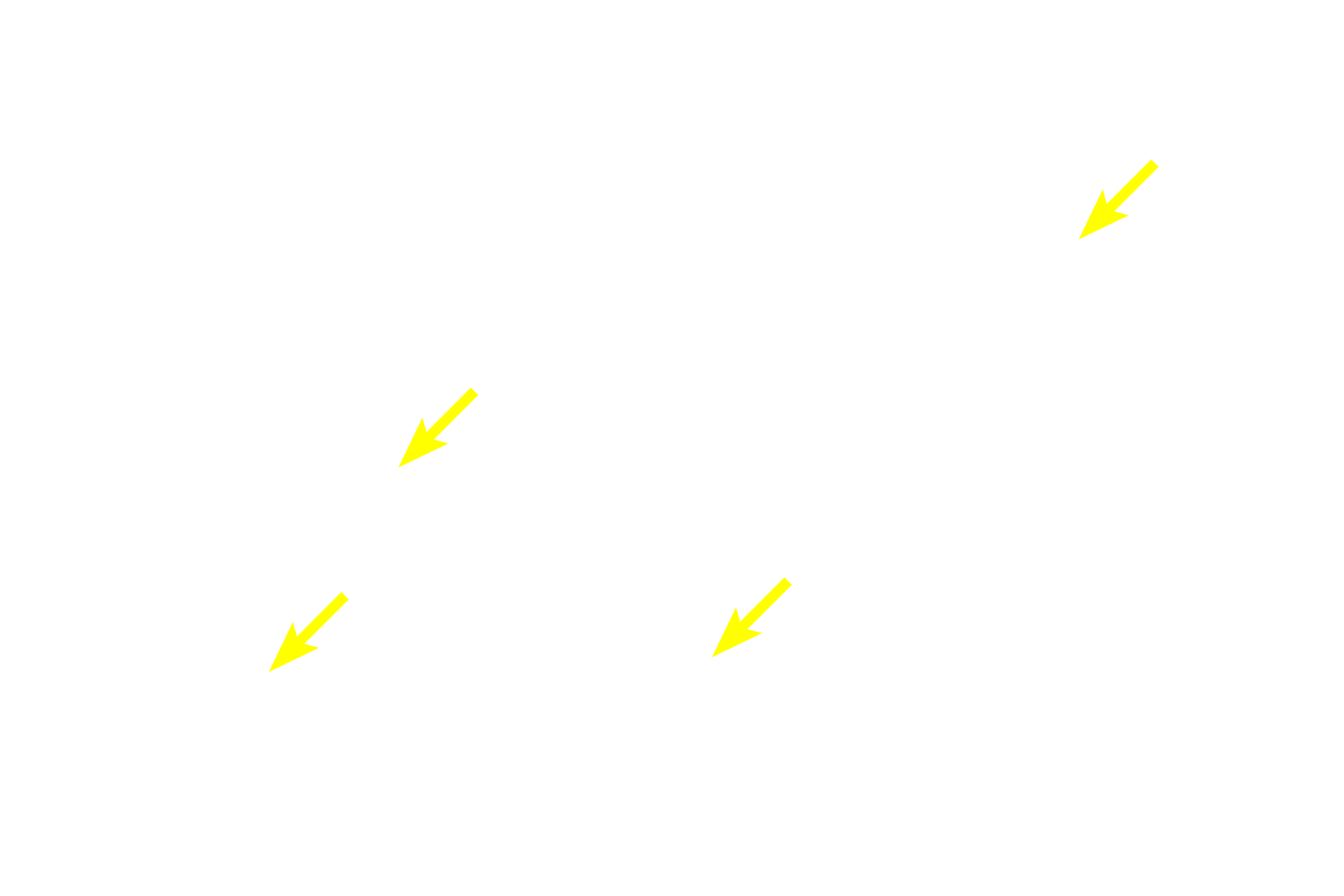 Diffuse lymphoid tissue >  <p>Diffuse lymphoid tissue consists of a loose network of lymphocytes located in the lamina propria throughout the gastrointestinal, respiratory and genitourinary tracts. In this location, it encounters and reacts to antigens passing through the mucosal epithelium, producing an immune response.</p>
