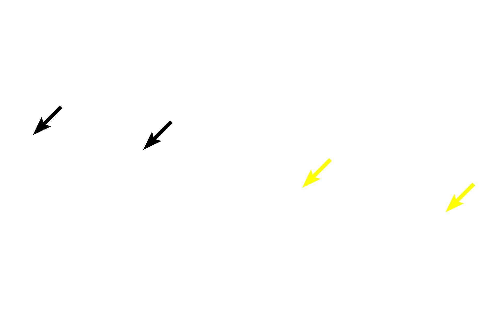 Diffuse lymphoid tissue <p>Primary lymphoid nodules consists of a spherical mass of unstimulated lymphocytes. These primary nodules, located in the lamina propria of the colon (l) and stomach (r), filter tissue fluid and respond to antigens encountered by the mucosa.  Following antigen stimulation, they can become a secondary nodule with the formation of a pale staining central region called the germinal center.</p>
