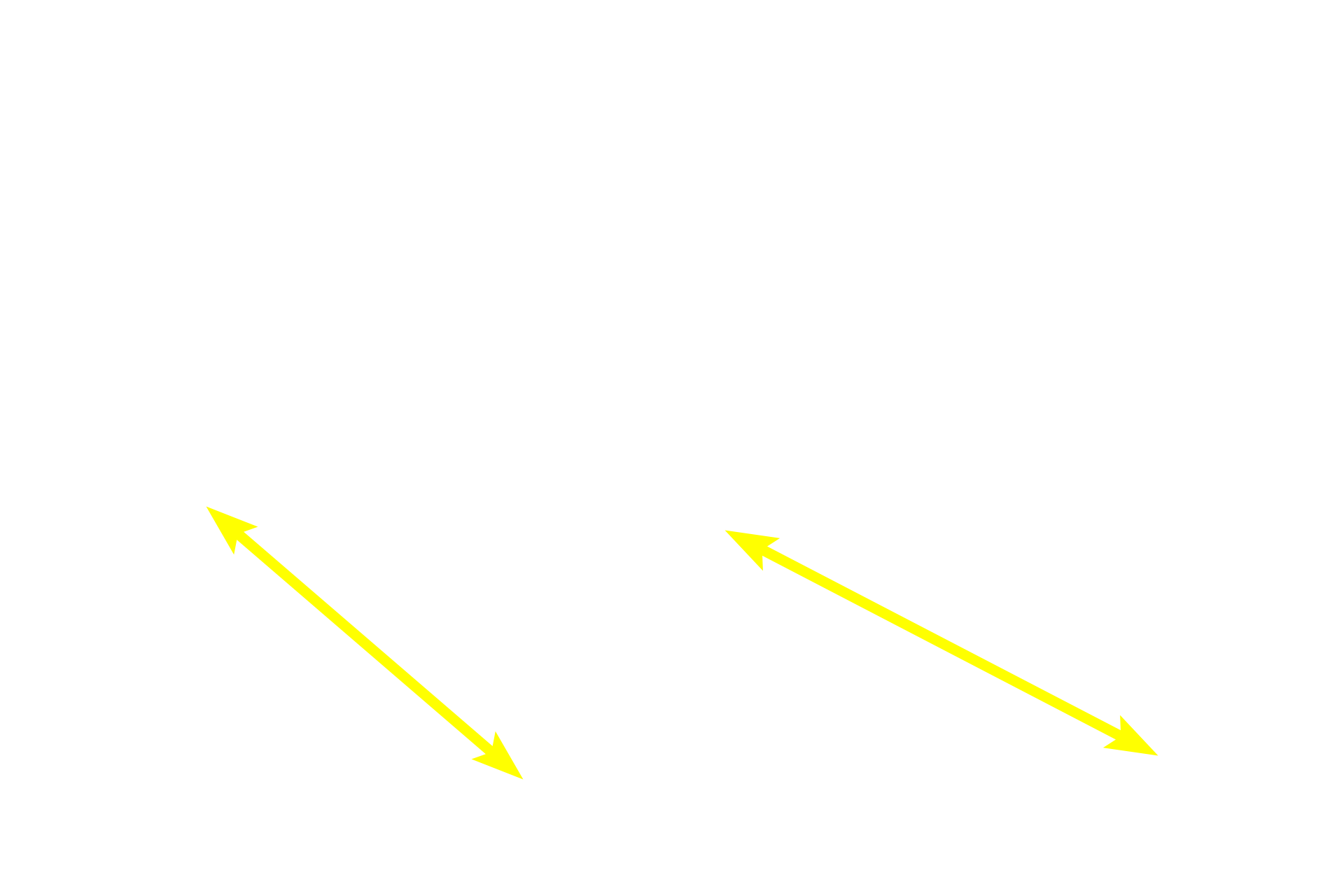 Primary lymphoid nodule <p>These images show primary lymphoid nodules in the colon. On the left, the nodule is confined to the mucosa; on the right, the mass of accumulating lymphocytes has ruptured through the muscularis mucosae, extending into the submucosa. Colon, 200x </p>
