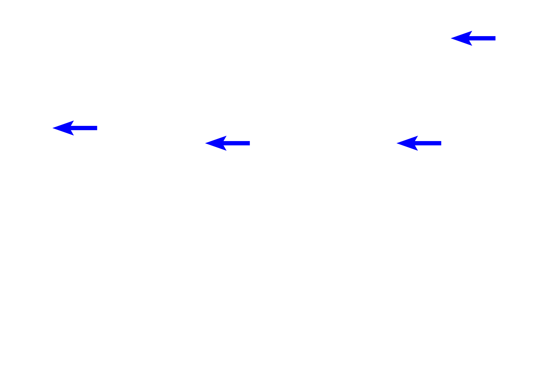 Diffuse lymphoid tissue <p>These images show primary lymphoid nodules in the colon. On the left, the nodule is confined to the mucosa; on the right, the mass of accumulating lymphocytes has ruptured through the muscularis mucosae, extending into the submucosa. Colon, 200x </p>
