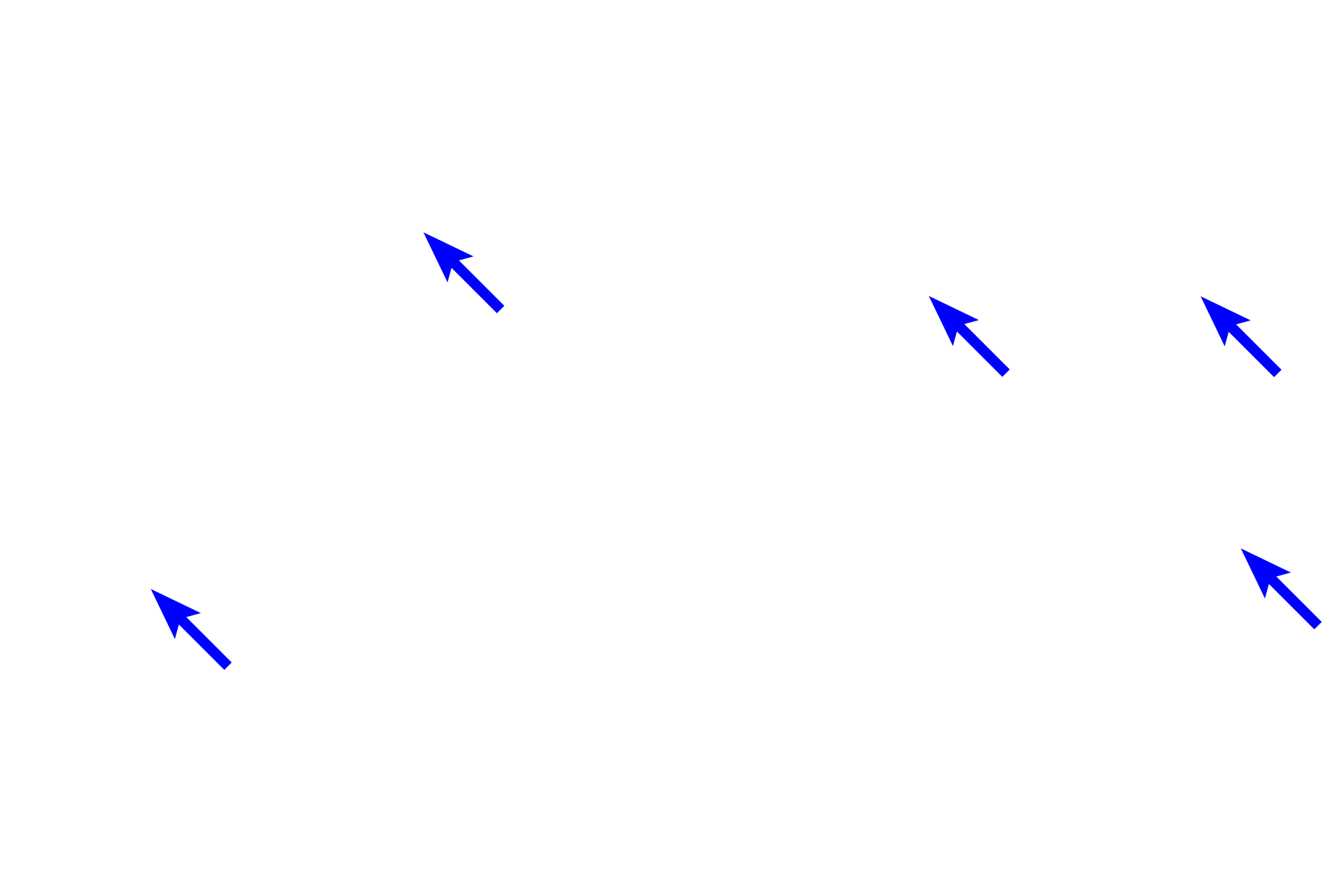 Intestinal glands <p>These images show primary lymphoid nodules in the colon. On the left, the nodule is confined to the mucosa; on the right, the mass of accumulating lymphocytes has ruptured through the muscularis mucosae, extending into the submucosa. Colon, 200x </p>
