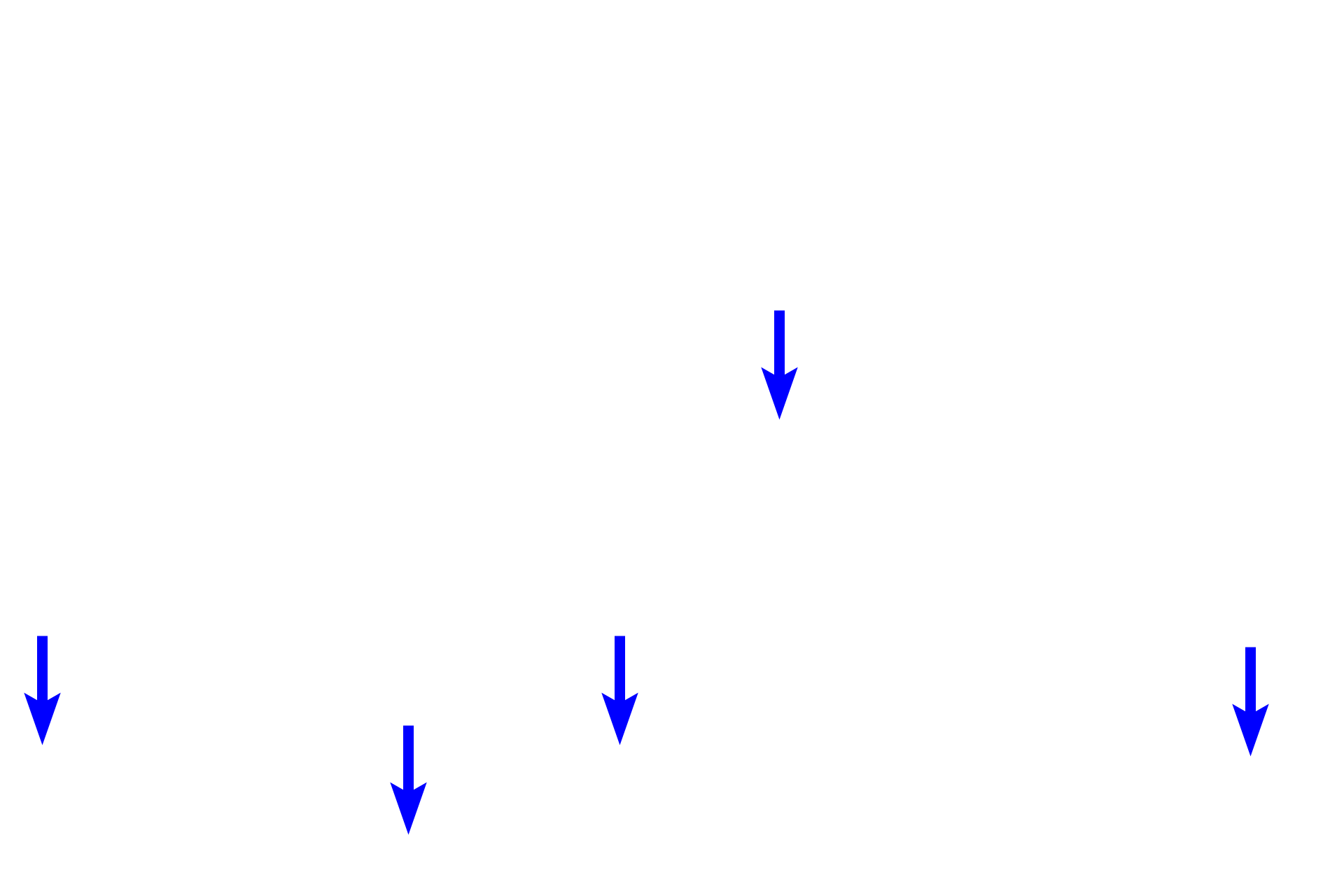 Muscularis mucosae <p>These images show primary lymphoid nodules in the colon. On the left, the nodule is confined to the mucosa; on the right, the mass of accumulating lymphocytes has ruptured through the muscularis mucosae, extending into the submucosa. Colon, 200x </p>
