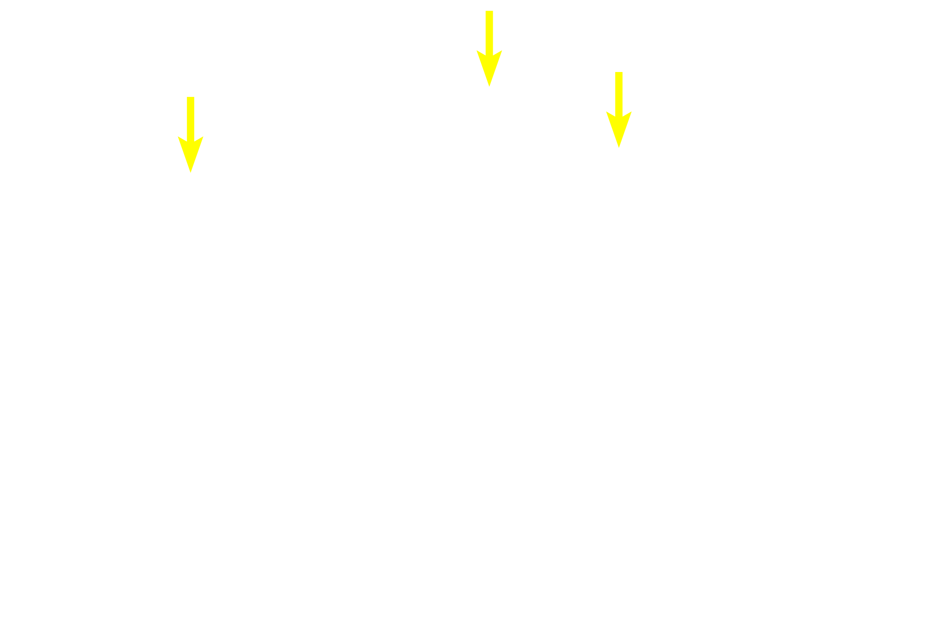  - Intestinal glands <p>With antigenic stimulation, primary nodules increase in size and develop a pale-staining central region called the germinal center. These are now referred to as secondary nodules. Germinal centers are a morphological indication of lymphoid tissue response to antigen and represent a cascade of events including activation and proliferation of lymphocytes, and generation of plasma cells and memory B cells. Colon, 200x</p>

