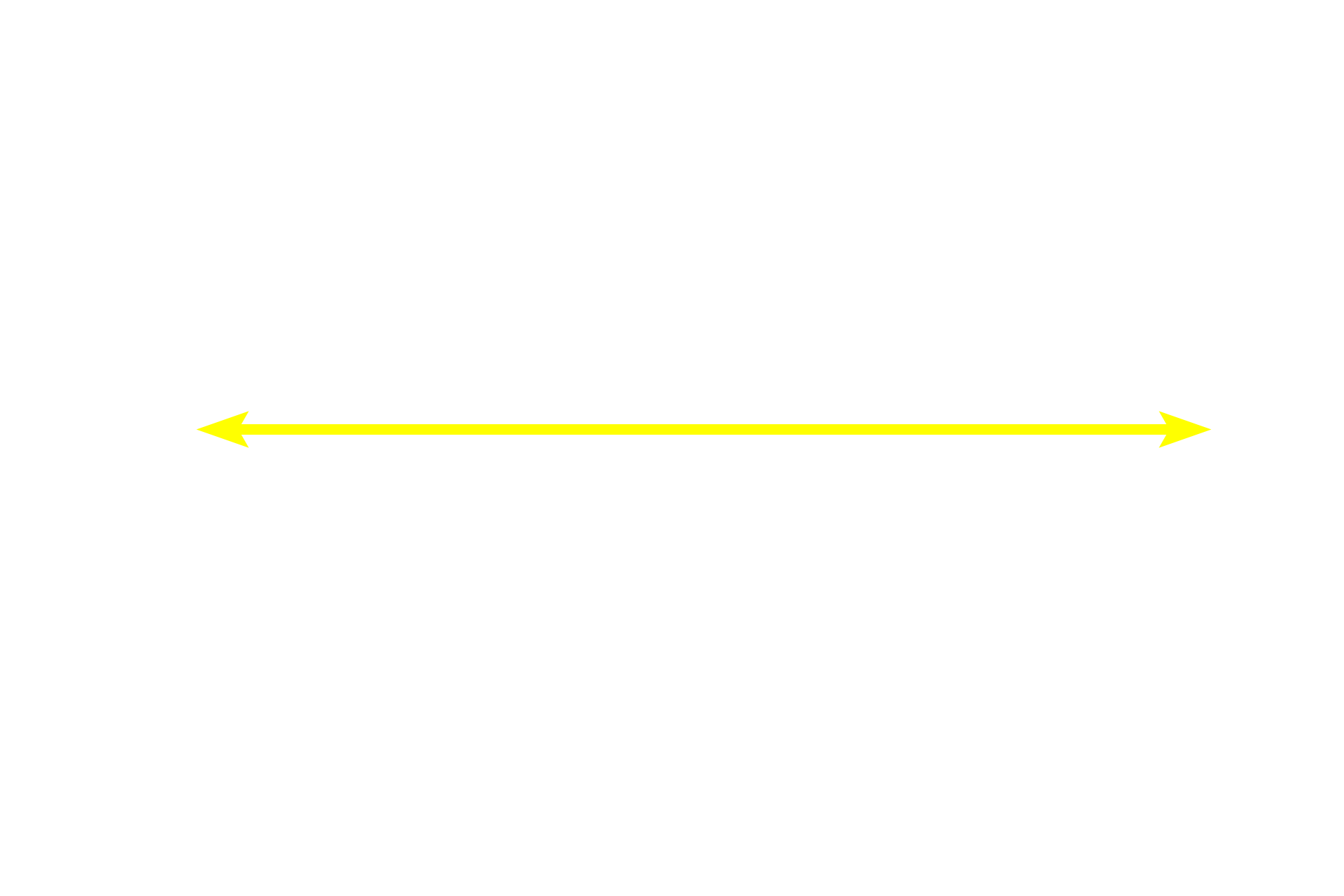 Secondary nodule <p>This secondary nodule demonstrates the zonation visible within the germinal center. In the dark zone, B cells proliferate and undergo random mutations of their antibody-producing genes. These B cells are then selected in the light zone, based on their antibody’s ability to bind to an antigen. Those with high-affinity antibodies undergo further proliferation and form large, pale-staining immunoblasts. Progeny of these cells become plasma cells and B memory cells. Cells with disadvantageous mutations are eliminated by apoptosis and phagocytosis by macrophages. Lymph node, 200x</p>
