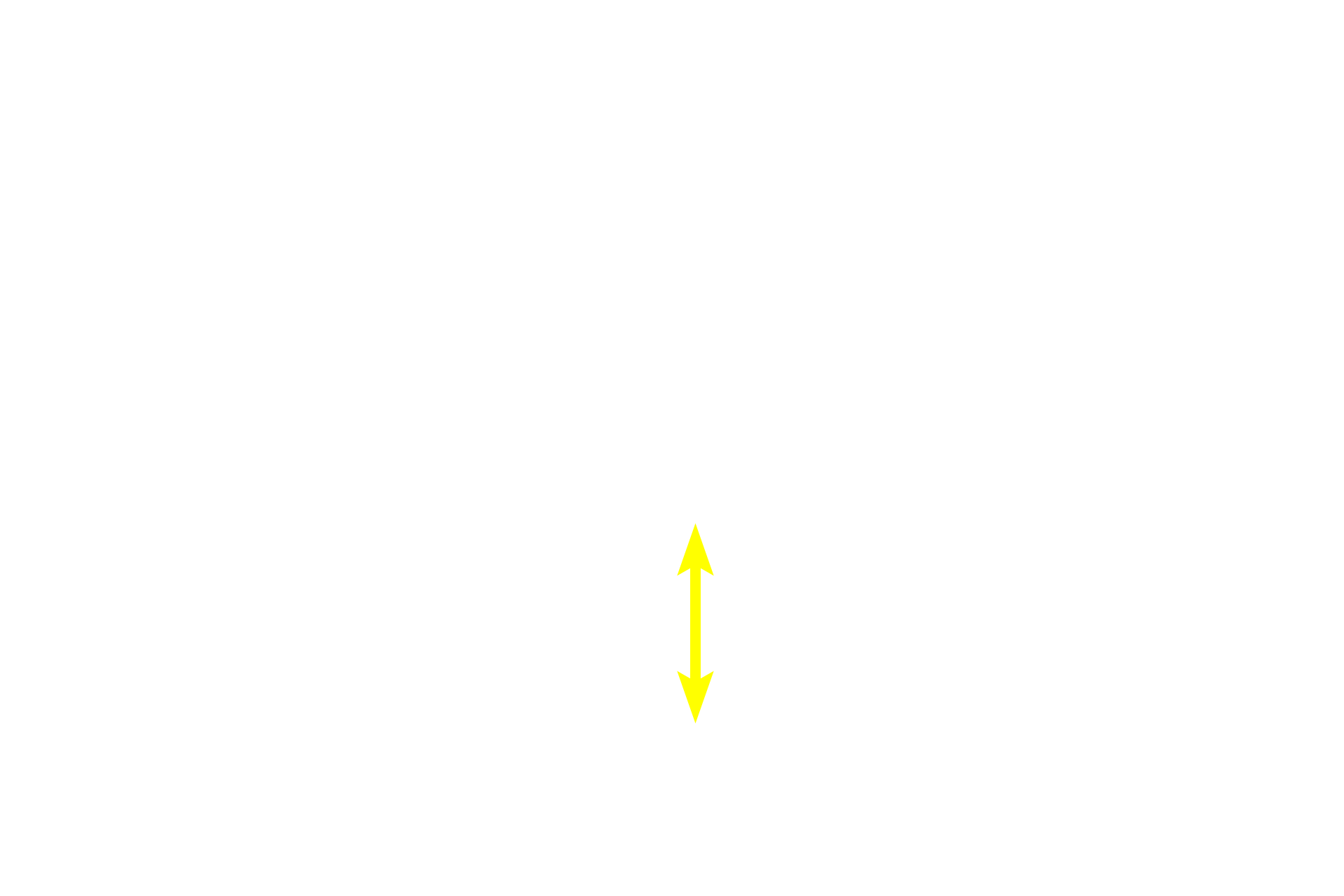  - Dark zone <p>This secondary nodule demonstrates the zonation visible within the germinal center. In the dark zone, B cells proliferate and undergo random mutations of their antibody-producing genes. These B cells are then selected in the light zone, based on their antibody’s ability to bind to an antigen. Those with high-affinity antibodies undergo further proliferation and form large, pale-staining immunoblasts. Progeny of these cells become plasma cells and B memory cells. Cells with disadvantageous mutations are eliminated by apoptosis and phagocytosis by macrophages. Lymph node, 200x</p>
