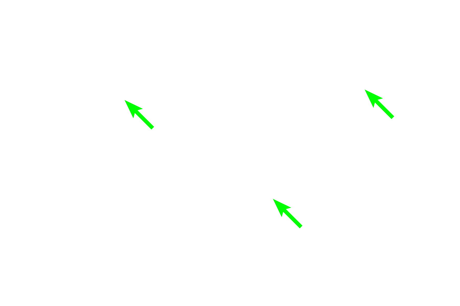 Phagocytosed remnants <p>In the germinal center, B cells proliferate, altering their antibody-producing genes to diversify the humoral immune response. The cells then undergo a selection process whereby only those with the highest affinity antibodies survive to form immunoblasts. The remaining cells are eliminated through apoptosis and subsequent phagocytosis by macrophages. These macrophages are termed tingible body macrophages because the phagocytosed remnants of the B cells in their cytoplasm are readily stainable. 1000x  </p>
