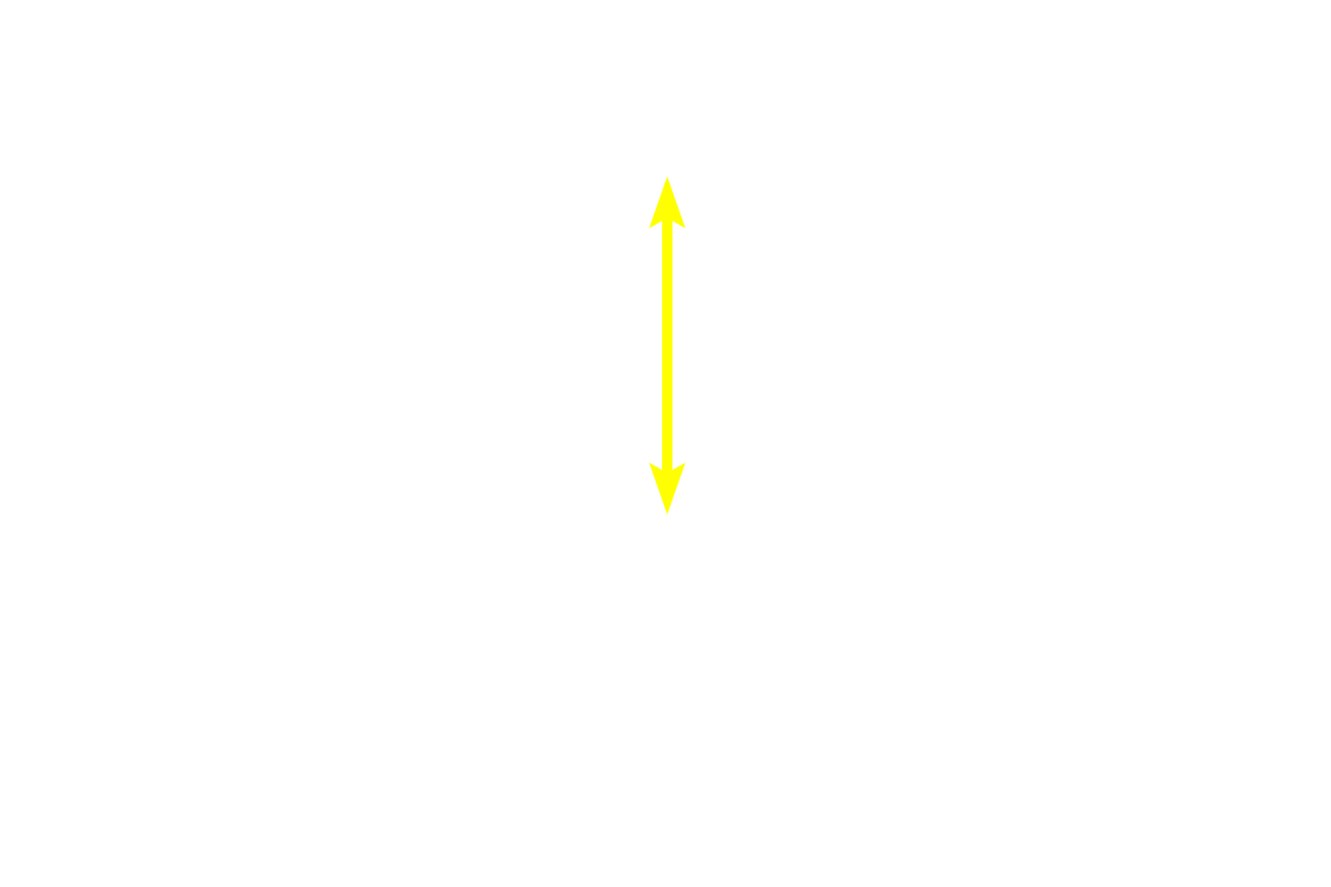  - Light zone <p>This secondary nodule demonstrates the zonation visible within the germinal center. In the dark zone, B cells proliferate and undergo random mutations of their antibody-producing genes. These B cells are then selected in the light zone, based on their antibody’s ability to bind to an antigen. Those with high-affinity antibodies undergo further proliferation and form large, pale-staining immunoblasts. Progeny of these cells become plasma cells and B memory cells. Cells with disadvantageous mutations are eliminated by apoptosis and phagocytosis by macrophages. Lymph node, 200x</p>
