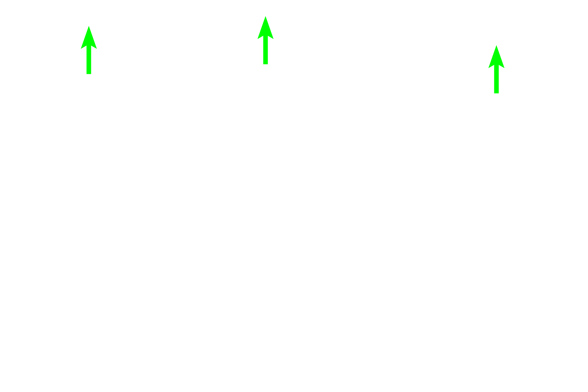 Capsule <p>This secondary nodule demonstrates the zonation visible within the germinal center. In the dark zone, B cells proliferate and undergo random mutations of their antibody-producing genes. These B cells are then selected in the light zone, based on their antibody’s ability to bind to an antigen. Those with high-affinity antibodies undergo further proliferation and form large, pale-staining immunoblasts. Progeny of these cells become plasma cells and B memory cells. Cells with disadvantageous mutations are eliminated by apoptosis and phagocytosis by macrophages. Lymph node, 200x</p>
