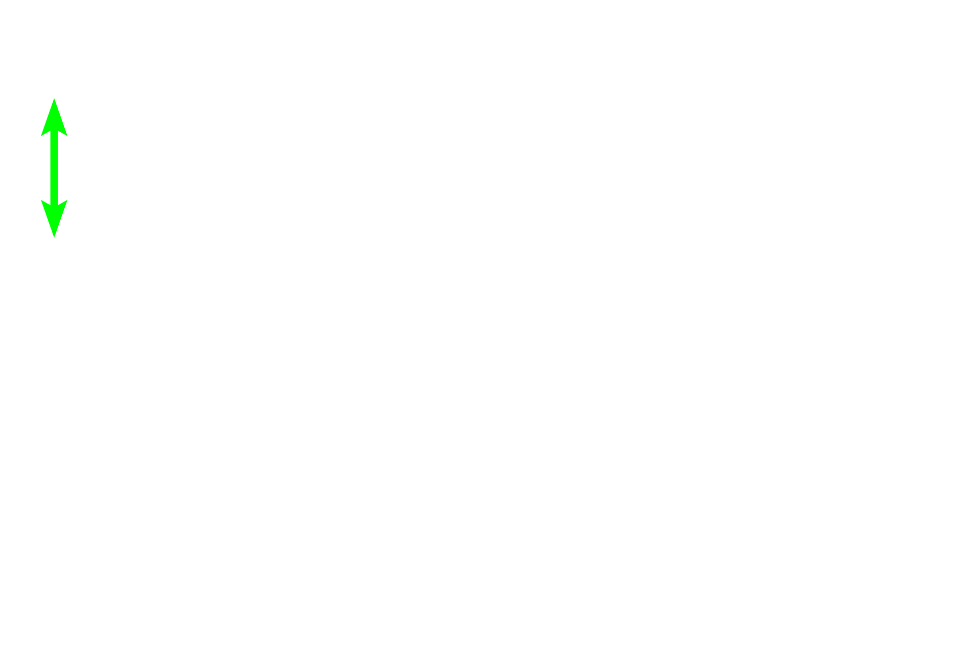 Subcapsular sinus <p>This secondary nodule demonstrates the zonation visible within the germinal center. In the dark zone, B cells proliferate and undergo random mutations of their antibody-producing genes. These B cells are then selected in the light zone, based on their antibody’s ability to bind to an antigen. Those with high-affinity antibodies undergo further proliferation and form large, pale-staining immunoblasts. Progeny of these cells become plasma cells and B memory cells. Cells with disadvantageous mutations are eliminated by apoptosis and phagocytosis by macrophages. Lymph node, 200x</p>

