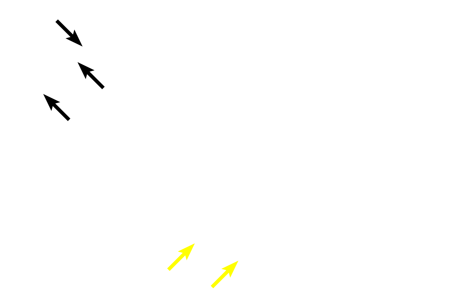 Suture > <p>Where cranial bones meet, they form suture joints, consisting of a thin layer of fibrous connective tissue between the bones. Suture (fibrous) joints are immobile or only slightly mobile. The connective tissue is not preserved in this dried specimen and so a gap is visible between the bones.</p>

