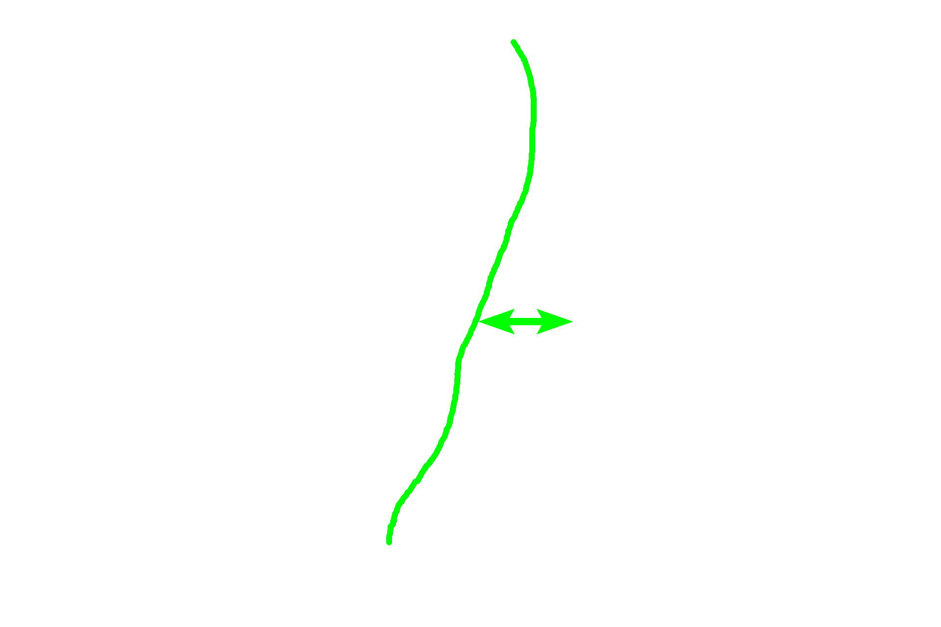  - Lamellar <p>The matrix of this spicule is in the process of being remodeled from woven into lamellar bone.</p>
