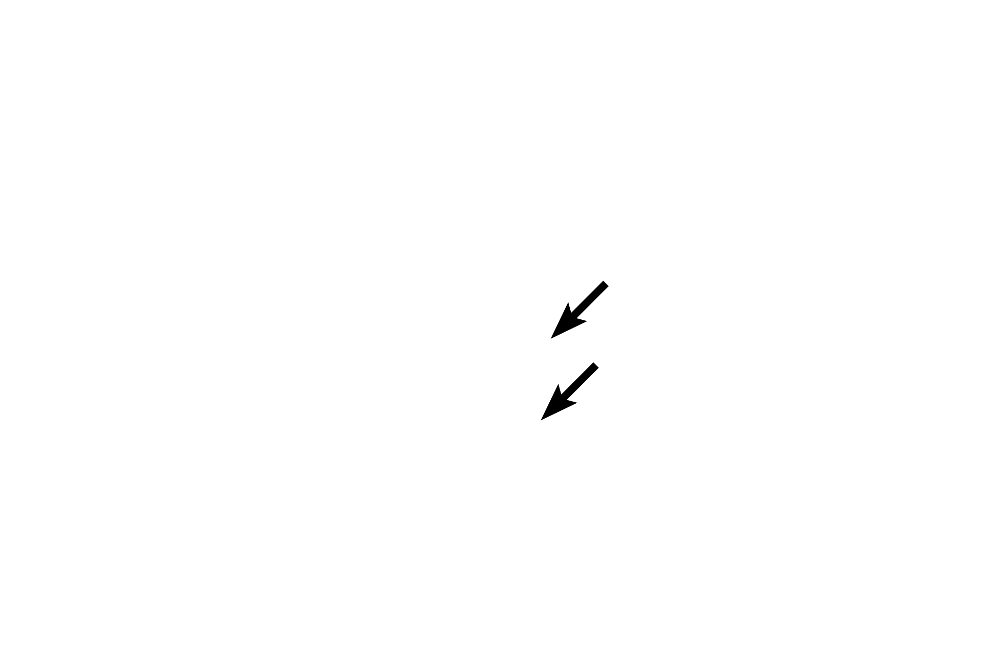 Osteoblasts > <p>Osteoblasts are depositing bone onto the surface of the spicule opposite from the osteoclast.</p>
