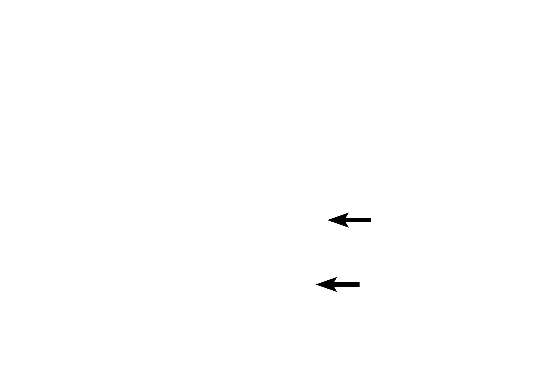 Osteoid <p>Osteoblasts are depositing bone onto the surface of the spicule opposite from the osteoclast.</p>
