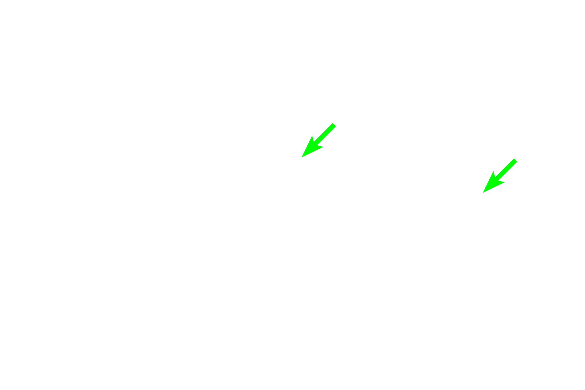  - Lacteal <p>In the duodenum, seen here, the submucosa also contains a mucus-secreting gland, named Brunner’s gland. This submucosal gland secretes an alkaline mucus that protects the intestinal mucosa from acidic gastric chyme. These glands are most numerous in the proximal regions of the duodenum. 40x</p>
