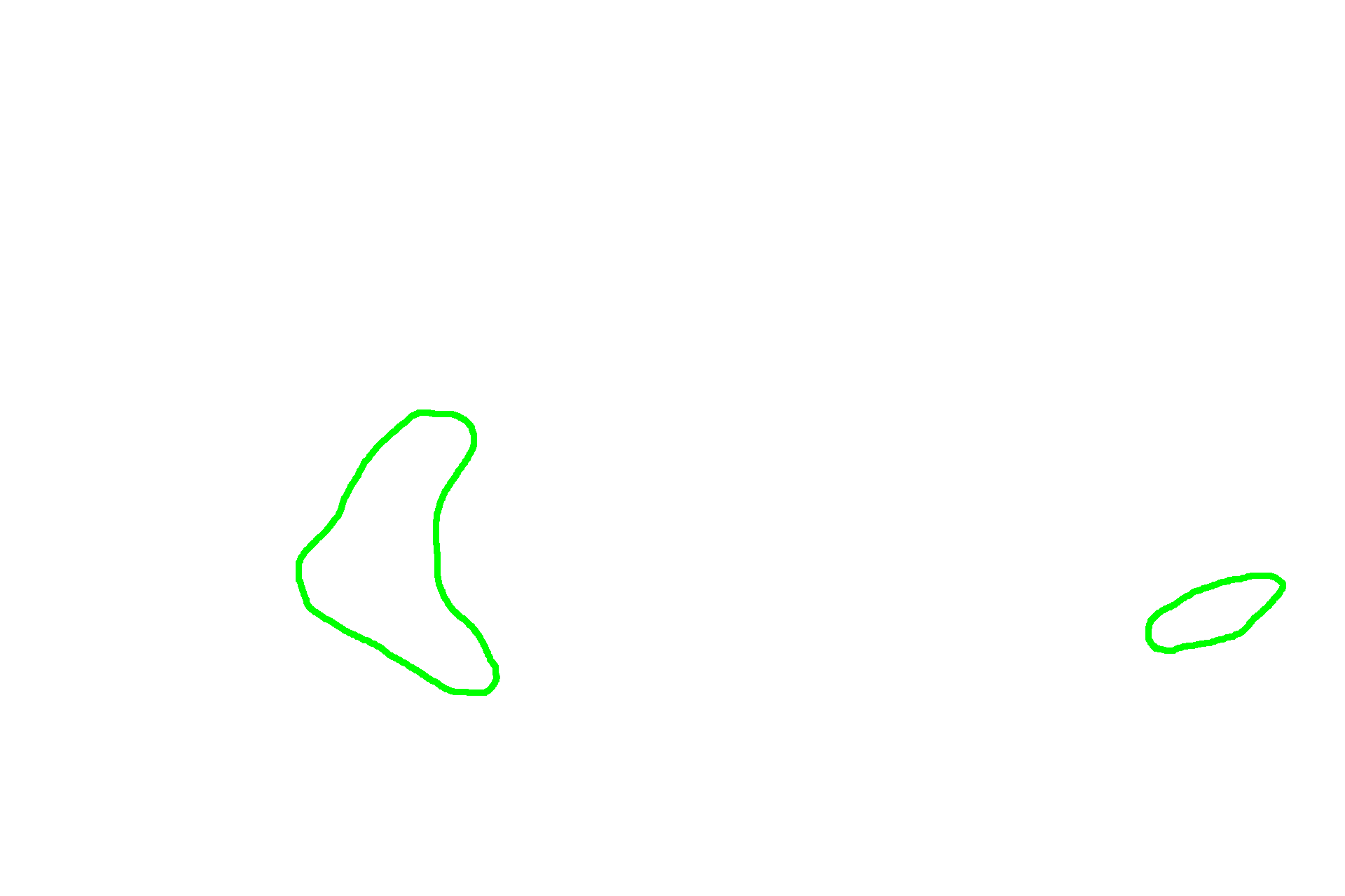  - Submucosal glands (Brunner's glands) <p>In the duodenum, seen here, the submucosa also contains a mucus-secreting gland, named Brunner’s gland. This submucosal gland secretes an alkaline mucus that protects the intestinal mucosa from acidic gastric chyme. These glands are most numerous in the proximal regions of the duodenum. 40x </p>
