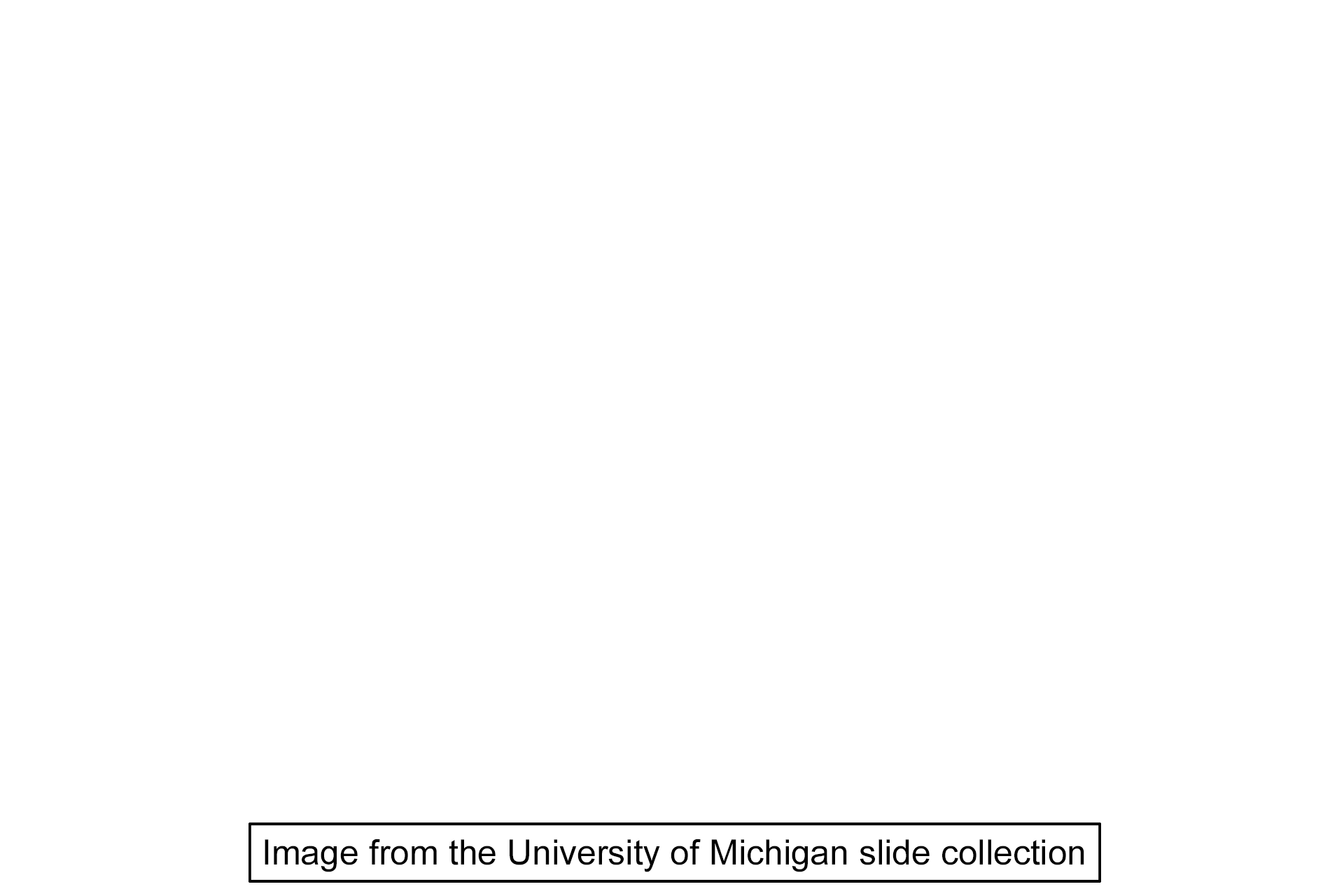 Image source > <p>This image was taken of a slide in the University of Michigan slide collection</p>
