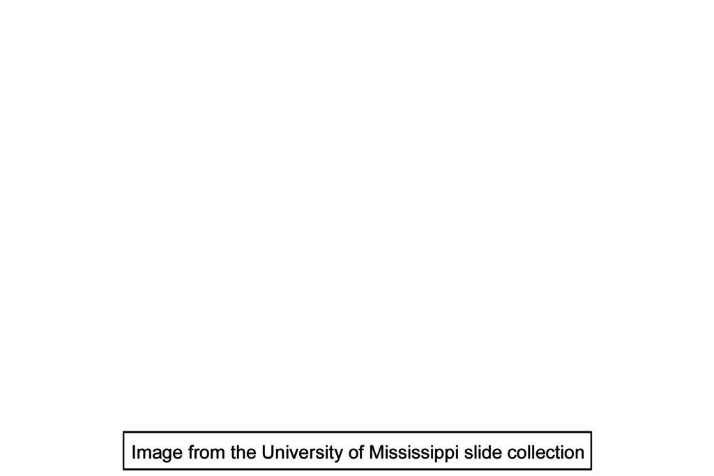 Image source > <p>Image taken of a slide in the University of Mississippi slide collection</p>

