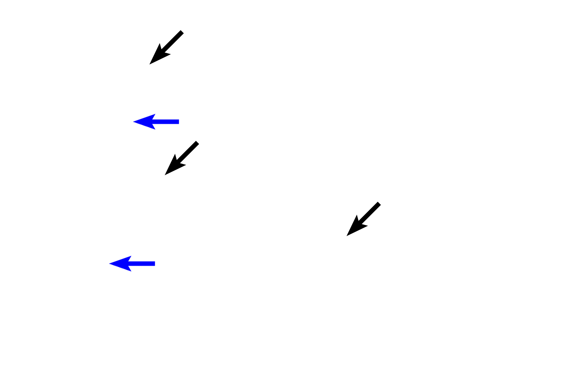 Epithelia > <p>Most of the larynx is lined by respiratory epithelium (blue arrows) except for the epiglottis and vocal folds, which are areas subjected to continual stress.  In those areas, the epithelium is stratified squamous moist (black arrows) </p>

