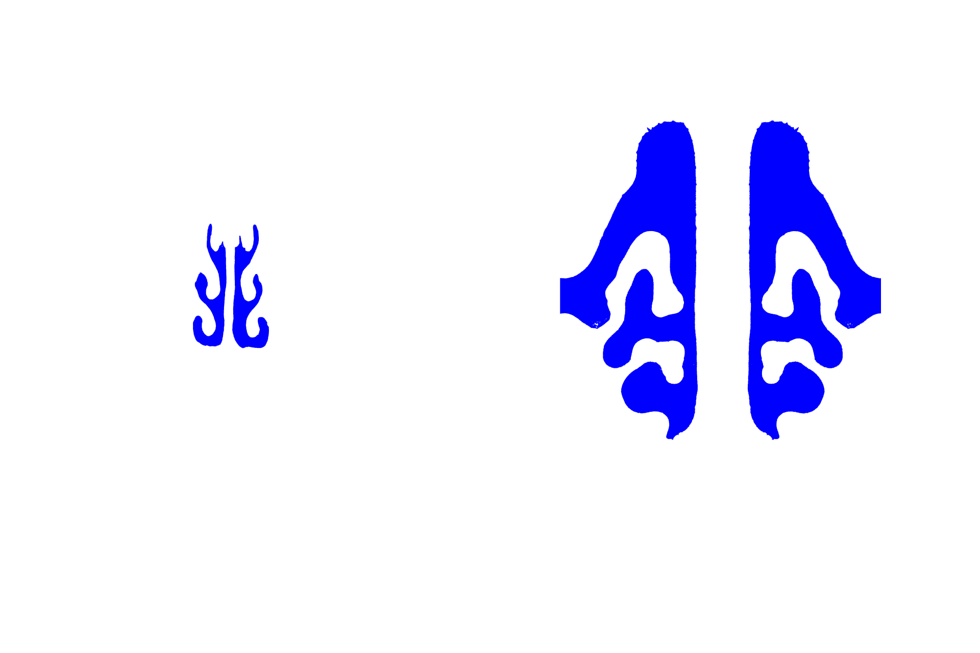 Nasal cavities >  <p>The nasal cavities are extrapulmonary passages that are part of the conducting portion of the respiratory system. The two nasal cavities are separated by the nasal septum and their lateral walls are formed by the bony nasal conchae (turbinate bones). Most of the nasal cavities are lined by respiratory epithelium.</p>
