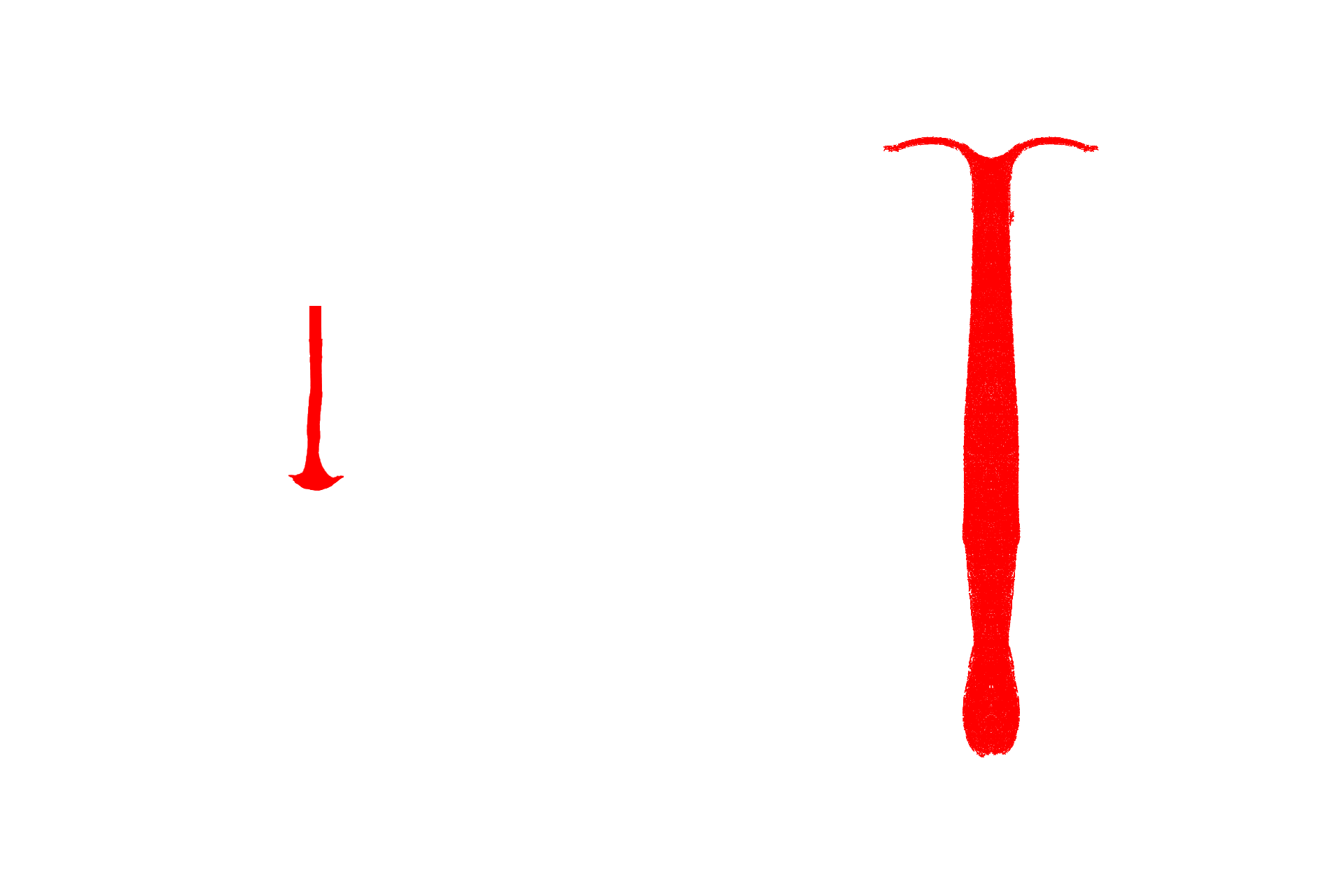 Nasal septum >  <p>The two nasal cavities are separated by the nasal septum which is formed by hyaline cartilage in its anterior region and bone posteriorly.</p>
