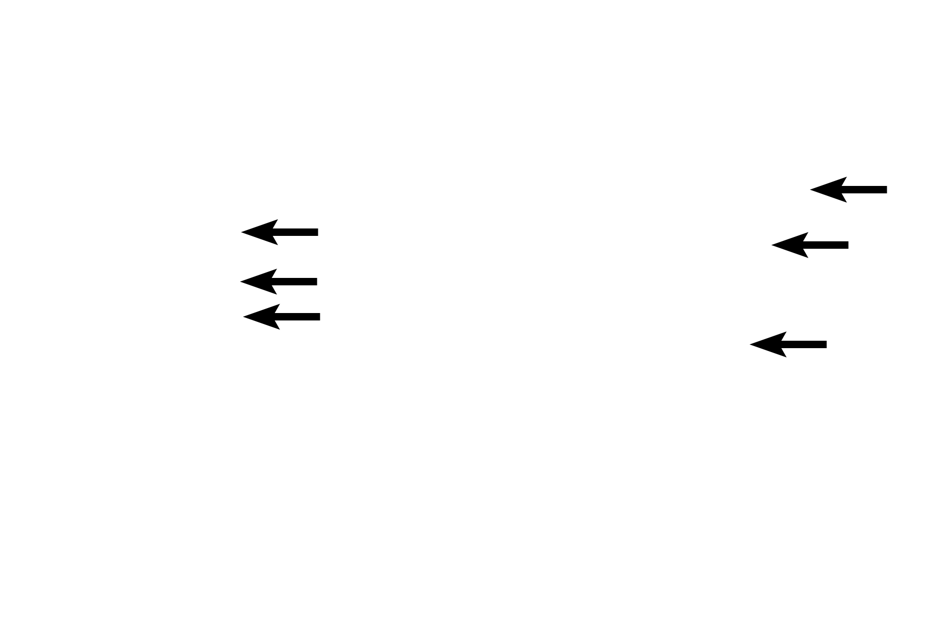 Conchae (turbinates) >  <p>Conchae are shelves of bone that protrude into the nasal cavity. The three pairs of conchae, inferior, middle and superior, are mostly lined by respiratory mucosa that serves to warm and moisten inspired air.</p>
