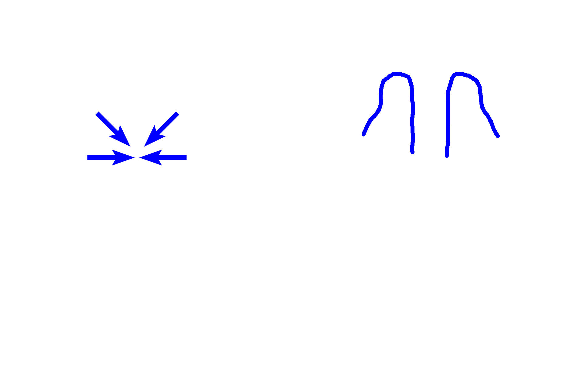 Olfactory epithelium >  <p>Highly specialized olfactory epithelium lines the upper portions of the nasal septum and the upper portions of the superior turbinate bones. Olfactory epithelium contains neurons that detect odorants in the air, transmitting that information to the brain for the perception of smell. The remainder of the nasal cavity is lined by respiratory epithelium. </p>
