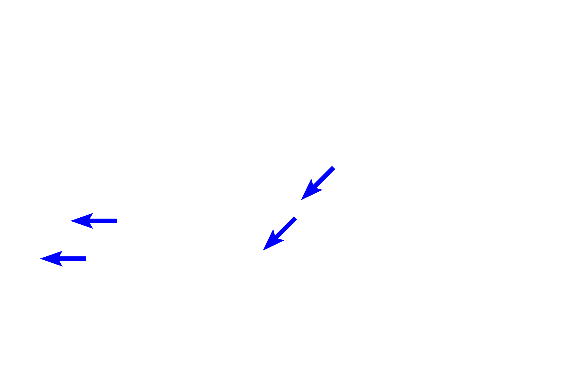  - Muco-serous gland <p>Respiratory mucosa consists of a pseudostratified respiratory epithelium with cilia and goblet cells. The underlying lamina propria contains numerous blood vessels that moderate the air temperature and muco-serous glands that moisten the surface. The mucosa, which lacks a smooth muscle layer and an elastic lamina, is supported either by cartilage or bone depending on the region.</p>

