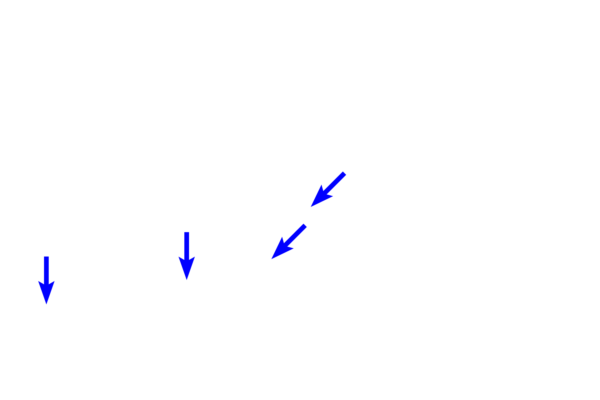 Bone <p>Respiratory mucosa consists of a pseudostratified respiratory epithelium with cilia and goblet cells. The underlying lamina propria contains numerous blood vessels that moderate the air temperature and muco-serous glands that moisten the surface. The mucosa, which lacks a smooth muscle layer and an elastic lamina, is supported either by cartilage or bone depending on the region.</p>
