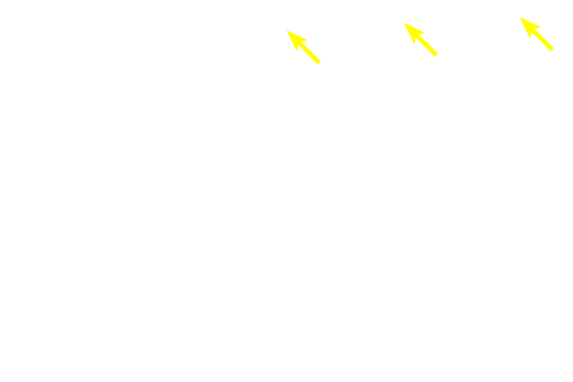  - Cilia >  <p>Olfactory neurons possess non-motile cilia that may be 5 to 10 times longer than regular cilia. They emerge from an enlargement at the end of the dendrite called the olfactory vesicle. These cilia possess odorant receptors for detecting olfactory stimuli. Supporting cells have microvilli only.  </p>
