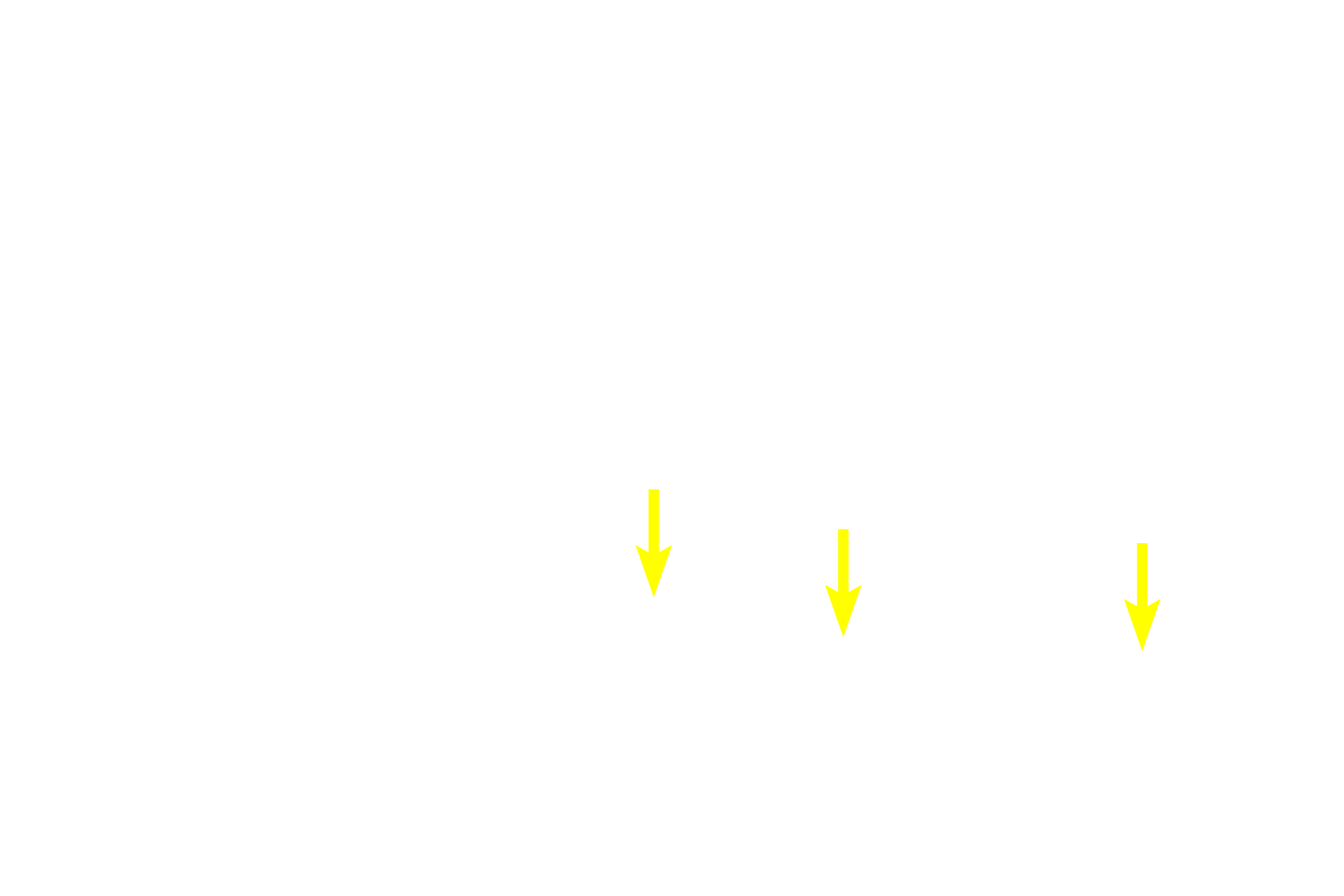  - Olfactory nerves > <p>Axons from olfactory neurons collect into fascicles that collectively form the olfactory nerve (cranial nerve I). They pass through the bony cribriform plate to enter the olfactory bulb of the brain. The olfactory mucosa also receives general sensory innervation to detect pain and temperature.</p>
