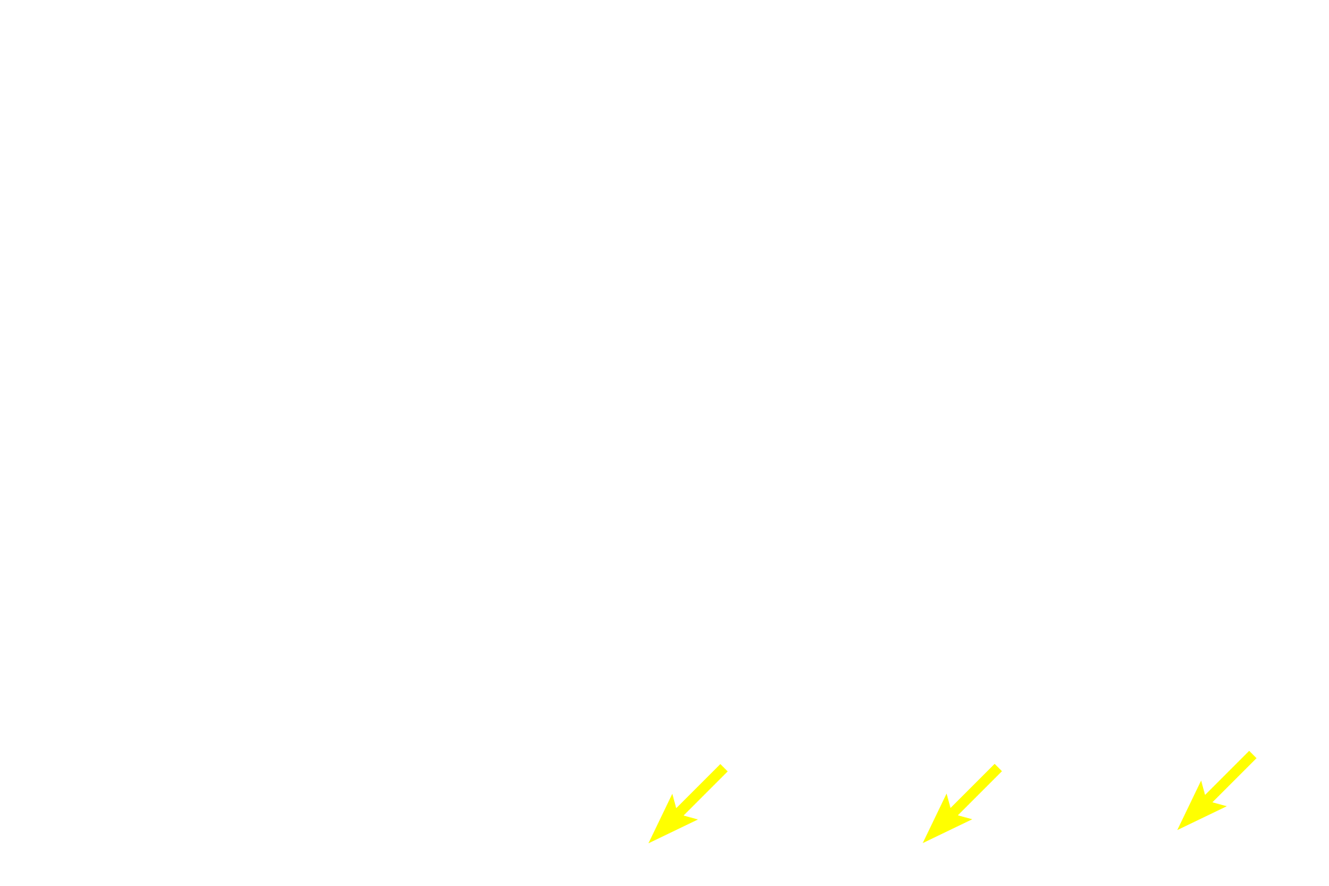 Bone <p>Axons from olfactory neurons collect into fascicles that collectively form the olfactory nerve (cranial nerve I). They pass through the bony cribriform plate to enter the olfactory bulb of the brain. The olfactory mucosa also receives general sensory innervation to detect pain and temperature.</p>
