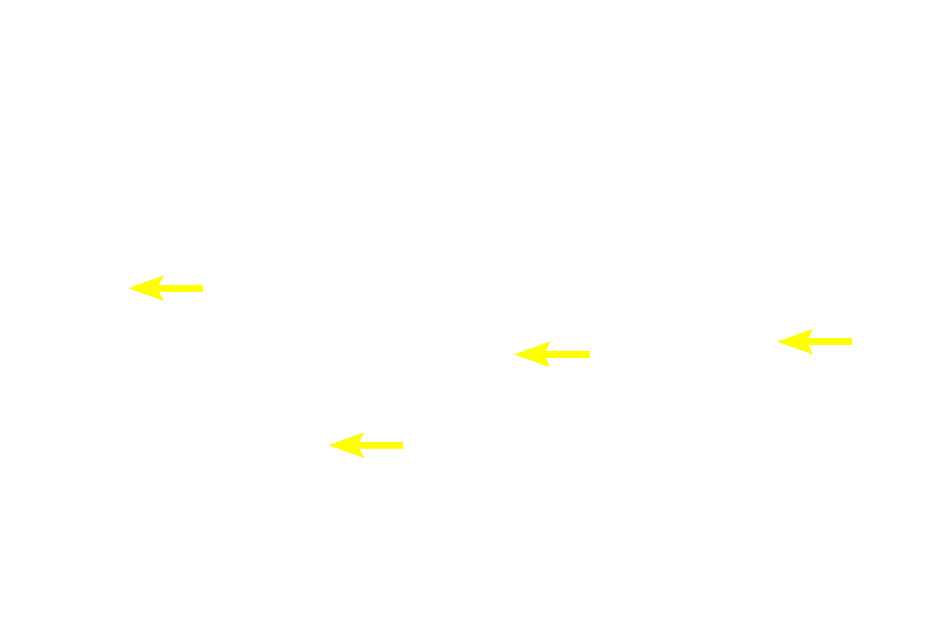 Olfactory neuron nuclei >  <p>Olfactory neurons constitute up to 50% of the cells in the epithelium. They are bipolar neurons that span the epithelium; their nuclei are generally located in the mid to lower regions of the epithelium. Dendrites extend apically, ending in an olfactory vesicle from which numerous, odorant-detecting, non-motile cilia extend. Axons from olfactory neurons form fascicles that pass through the cribriform plate to enter the olfactory bulb of the brain. Collectively, they form the olfactory nerve (cranial nerve I).</p>
