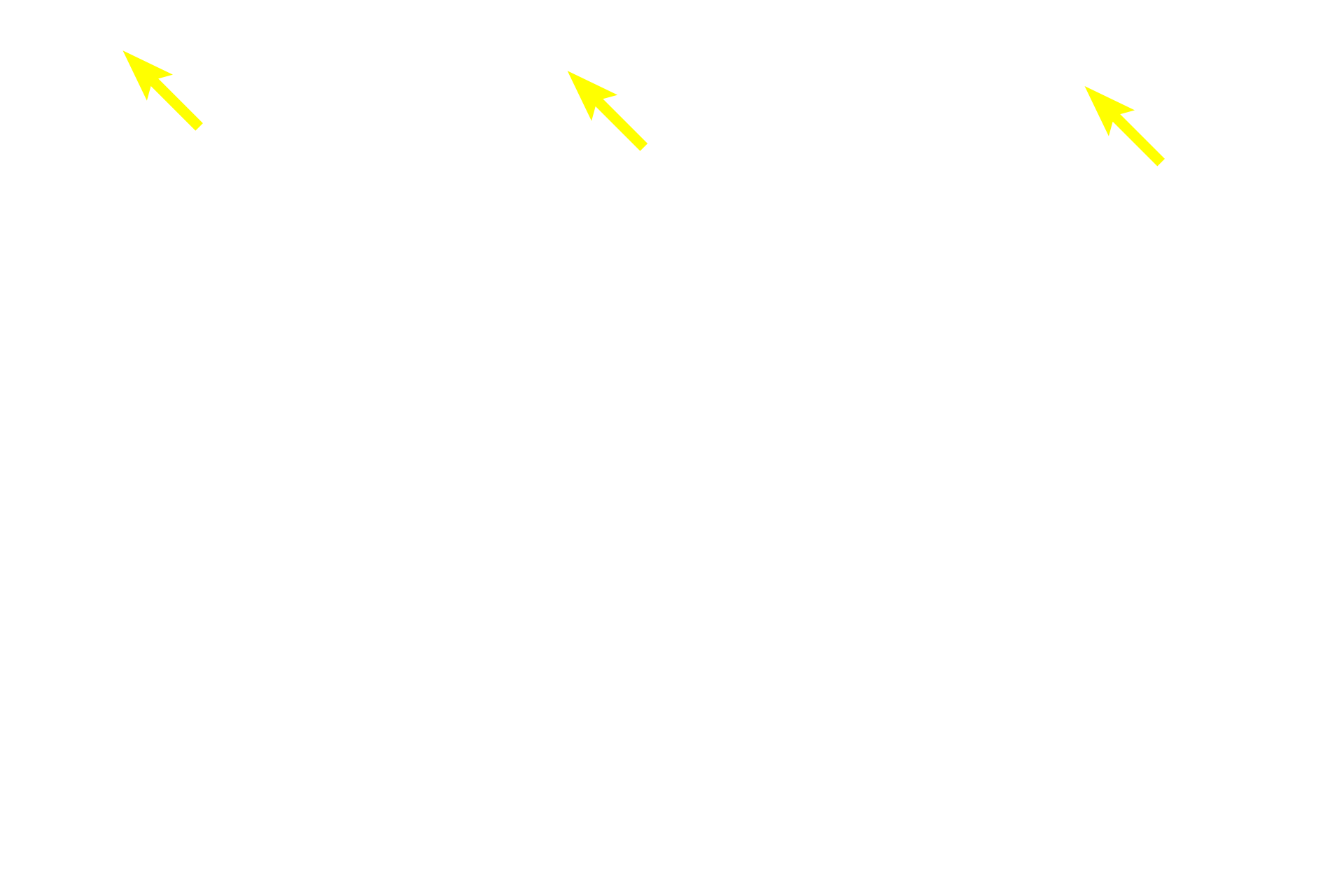  - Cilia >  <p>Cilia on olfactory neurons are non-motile and express odorant receptors specific for each neuron. They extend from a knob-like swelling at the end of the dendrite called the olfactory vesicle</p>
