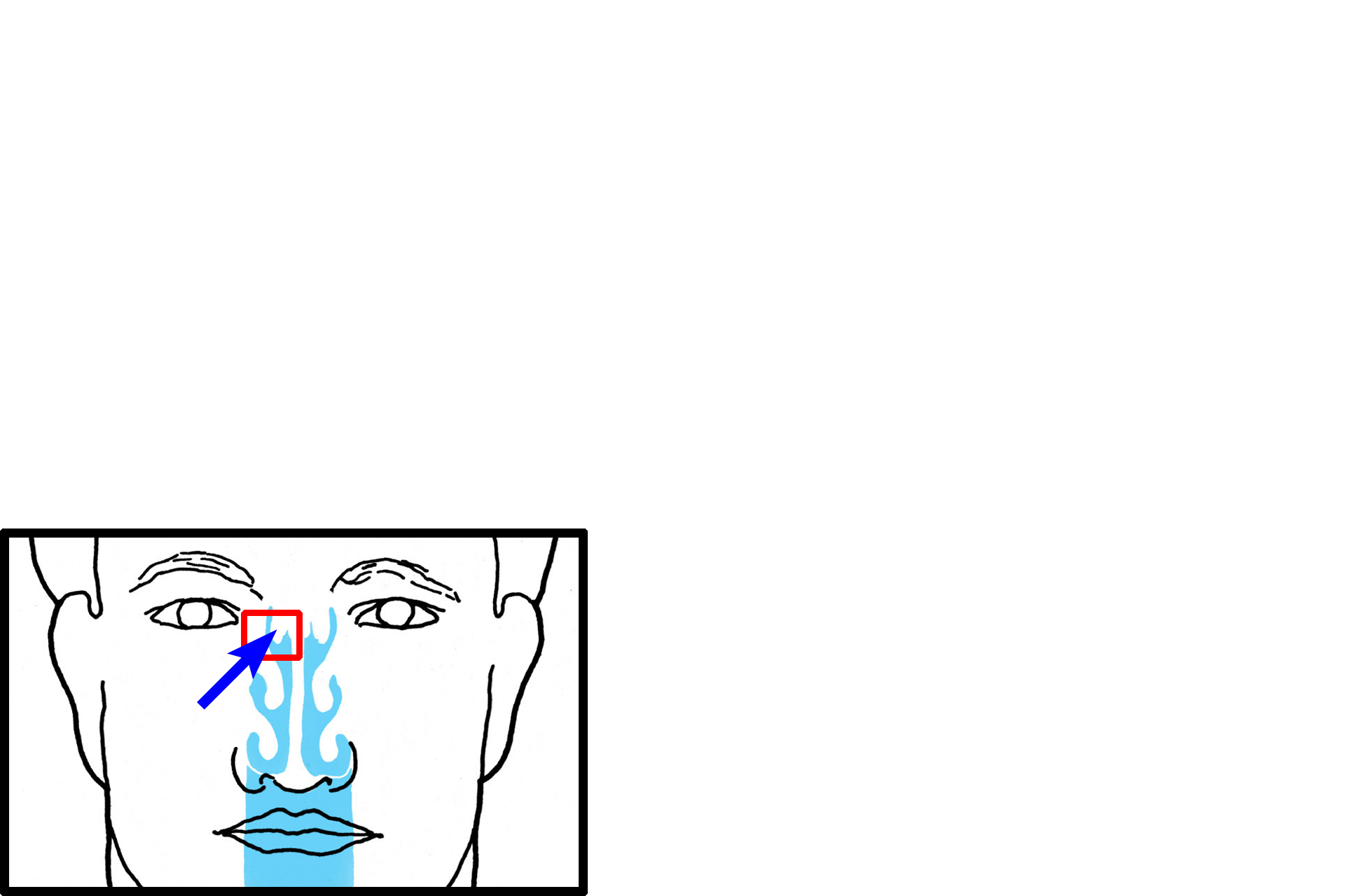 Orientation > <p>The outline in the inset shows the location from which this section was taken, including the superior concha (arrow) extending into the superior region of the nasal cavity. </p>
