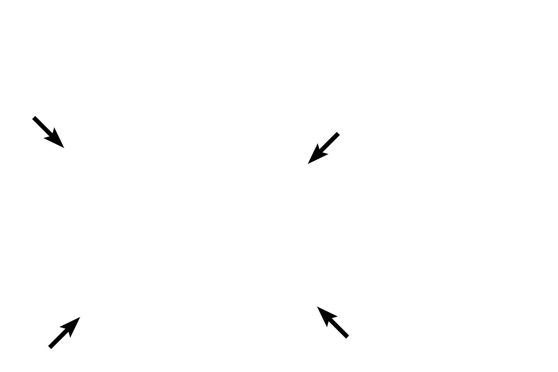Cartilage ring <p>The trachea is an extrapulmonary component of the conducting portion, continuing inferiorly from the larynx. It lies anterior to the esophagus and its walls are supported by C-shaped cartilage rings, whose openings face the esophagus. The two main lobes of the thyroid gland are visible at the lateral boundaries of the trachea. The trachea is about 2.5 cm in diameter and 10-12 cm long. It bifurcates into left and right primary (main) bronchi which enter the lung. The histological structure of the trachea and main bronchi is similar. 10x</p>

