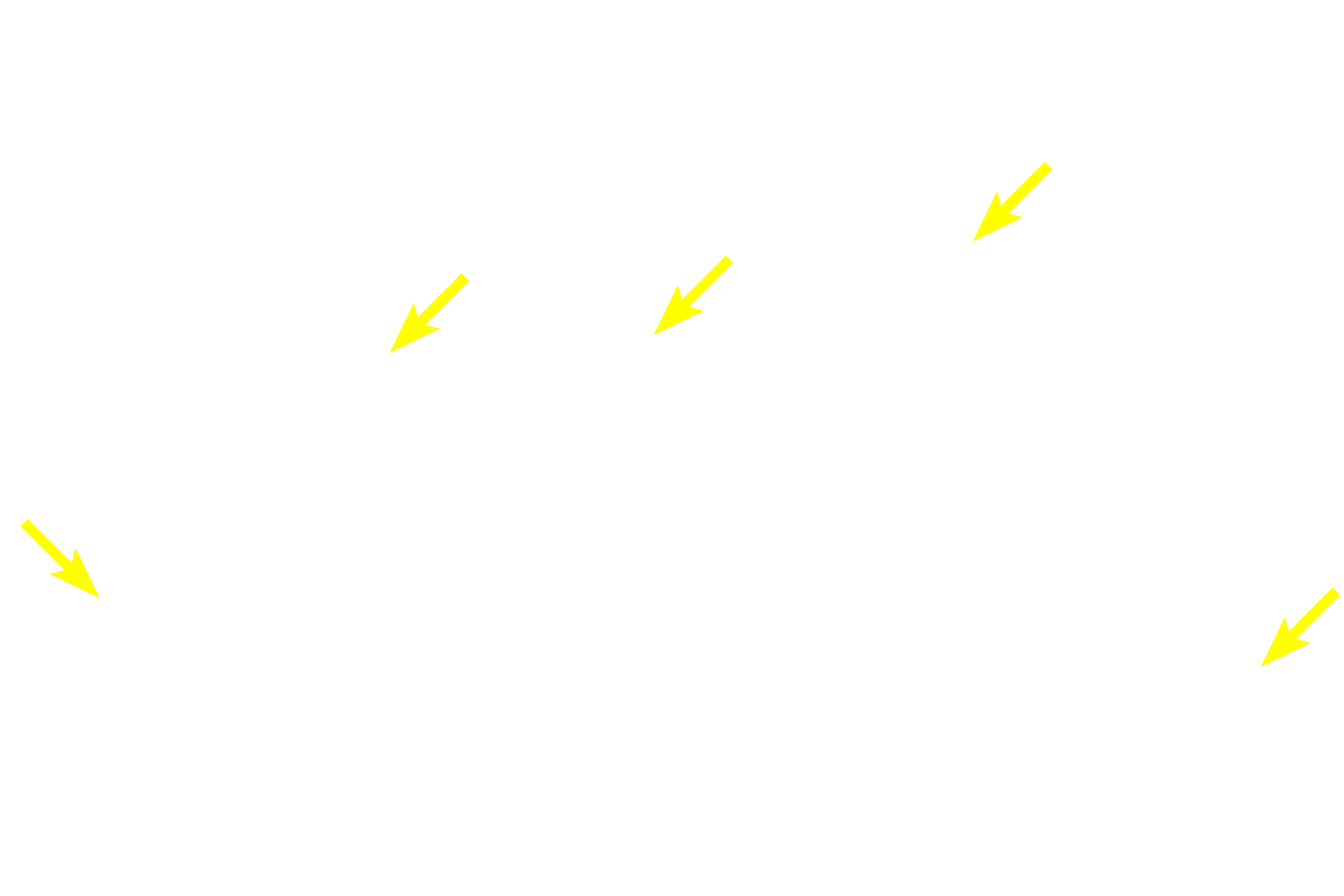 Mixed glands <p>The trachealis muscle is smooth muscle that spans the opening between the ends of each cartilage ring. Contraction of the muscle constricts the trachea thereby aiding in coughing by increasing airflow velocity. Its flexibility also facilitates swallowing by allowing the esophagus to expand. Mixed gland frequently accumulate next this muscle. 100x </p>
